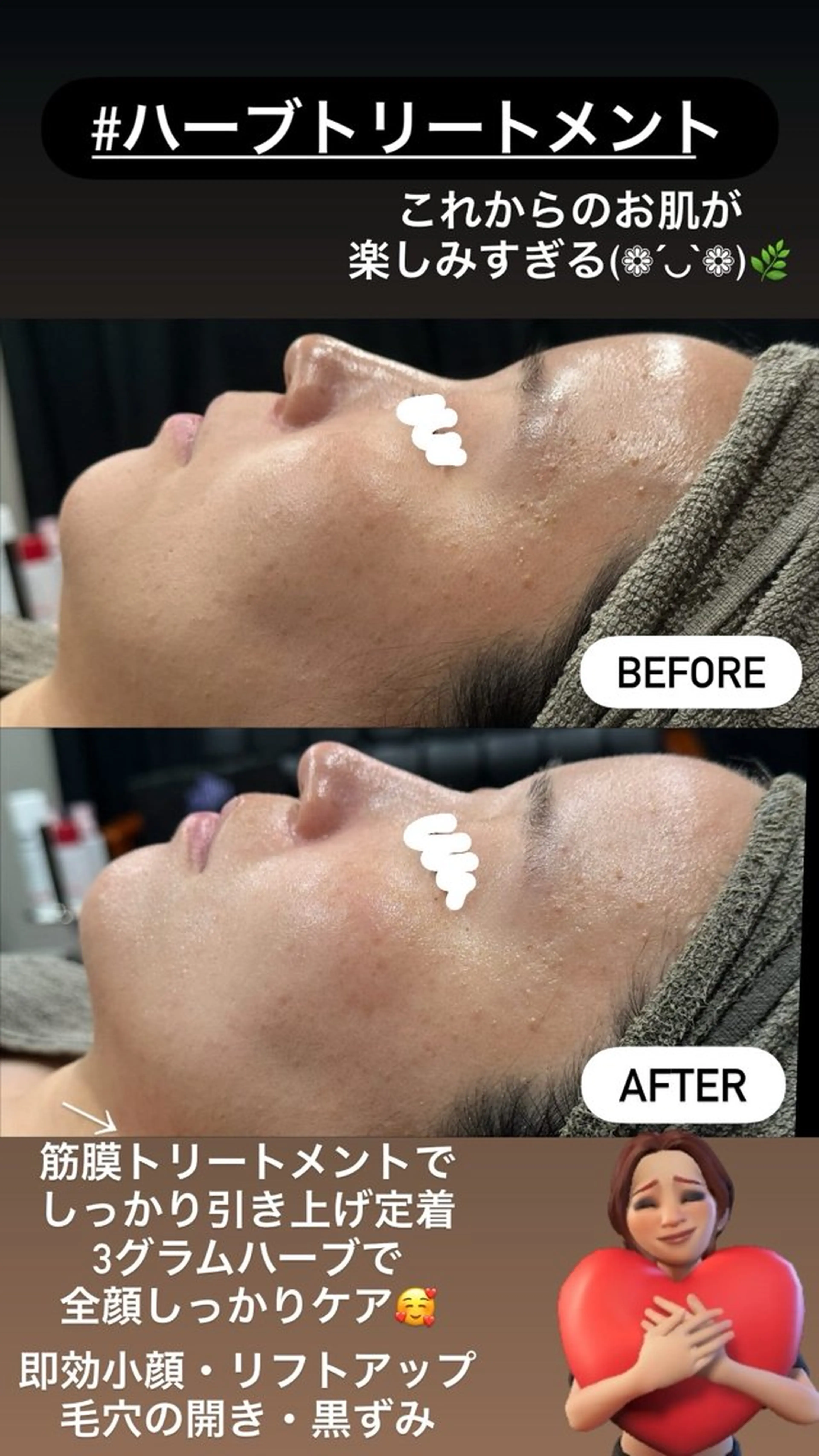 エステ LiZA エステティックサロンのエステ・リラクイメージ