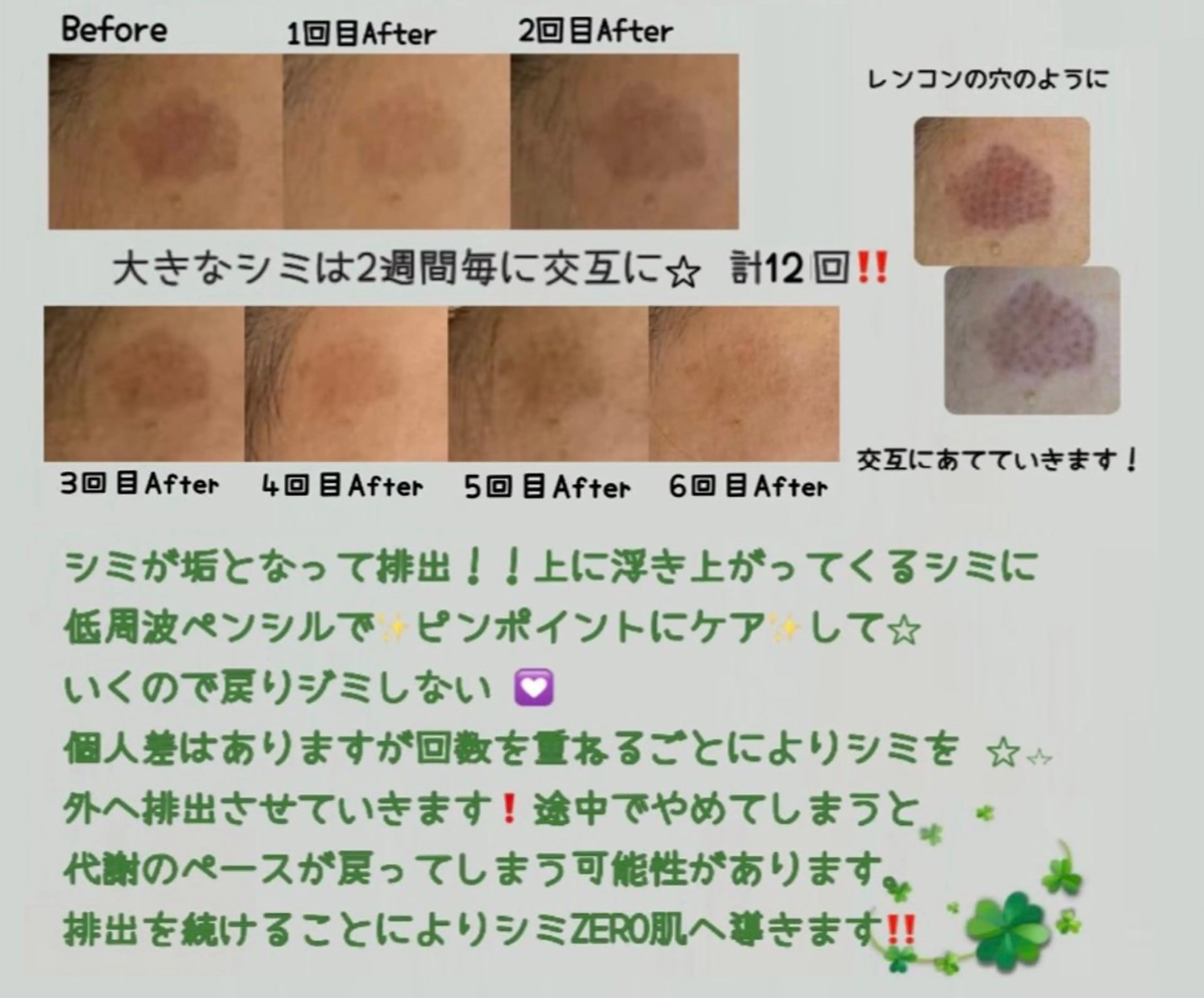 エステ ヴィーナス ビューティーのエステ・リラクイメージ