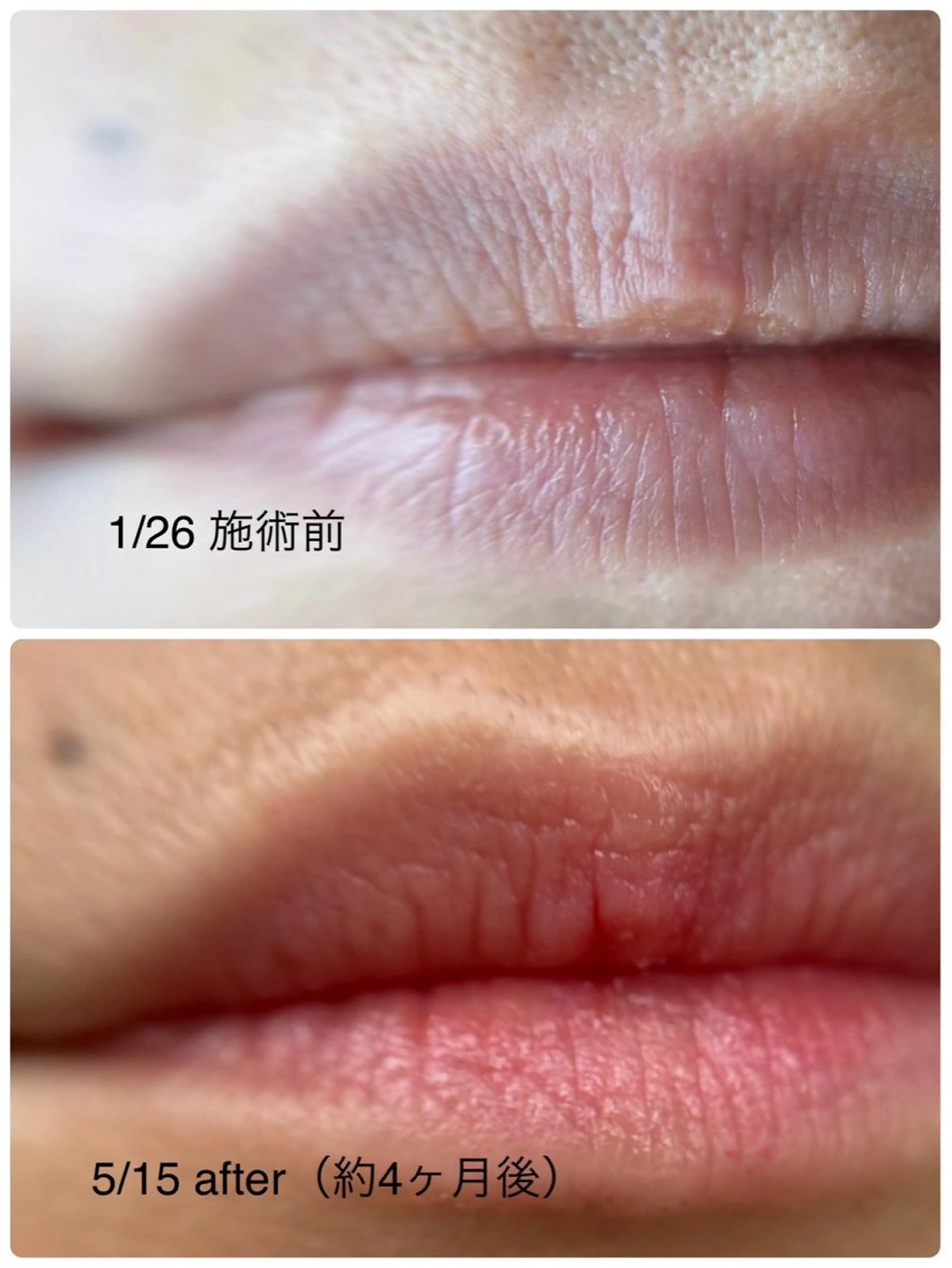 本気で痩せたい方へ 痩身専門サロンのエステ・リラクイメージ