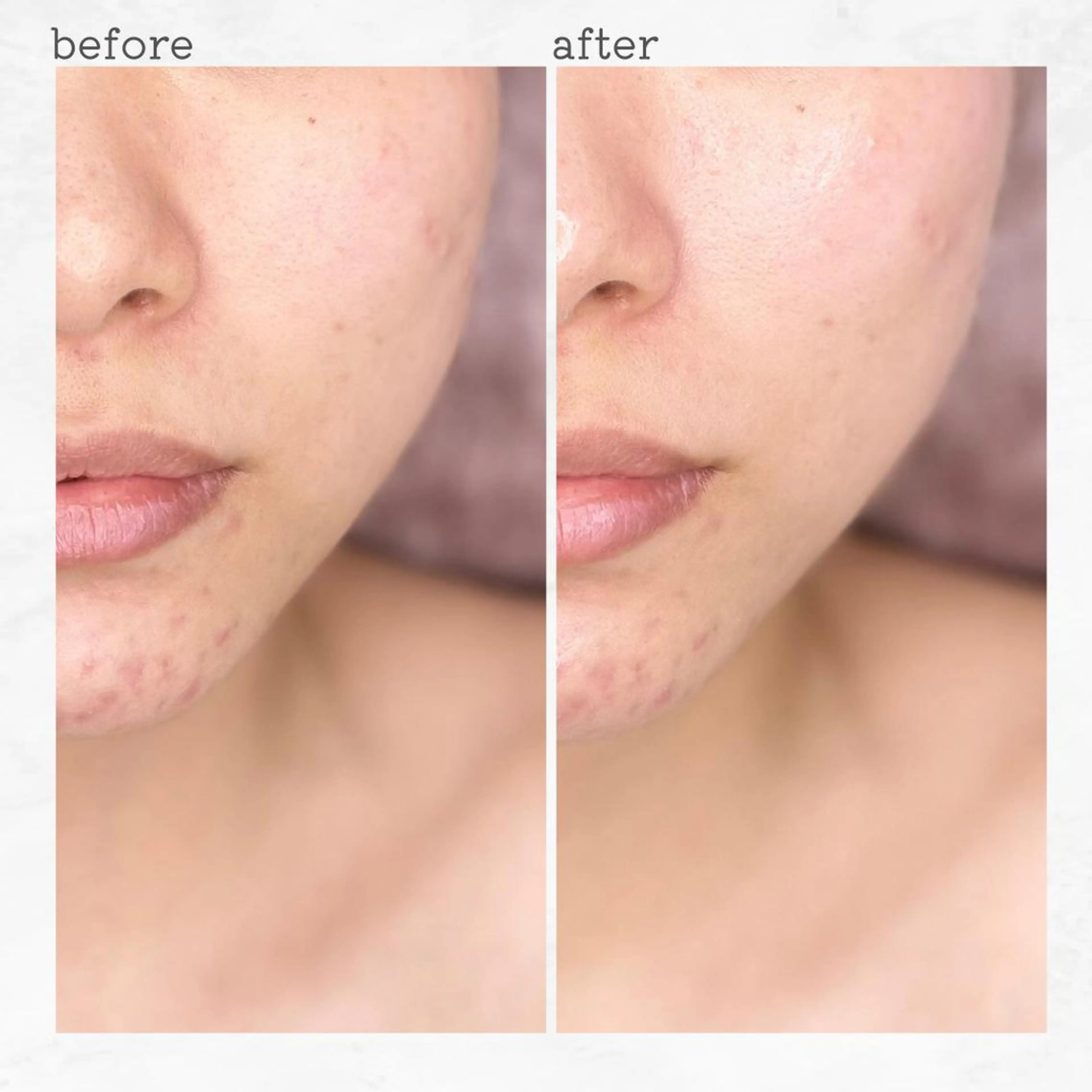 エステ 眉とお肌の専門サロン RioL / Aiのエステ・リラクイメージ