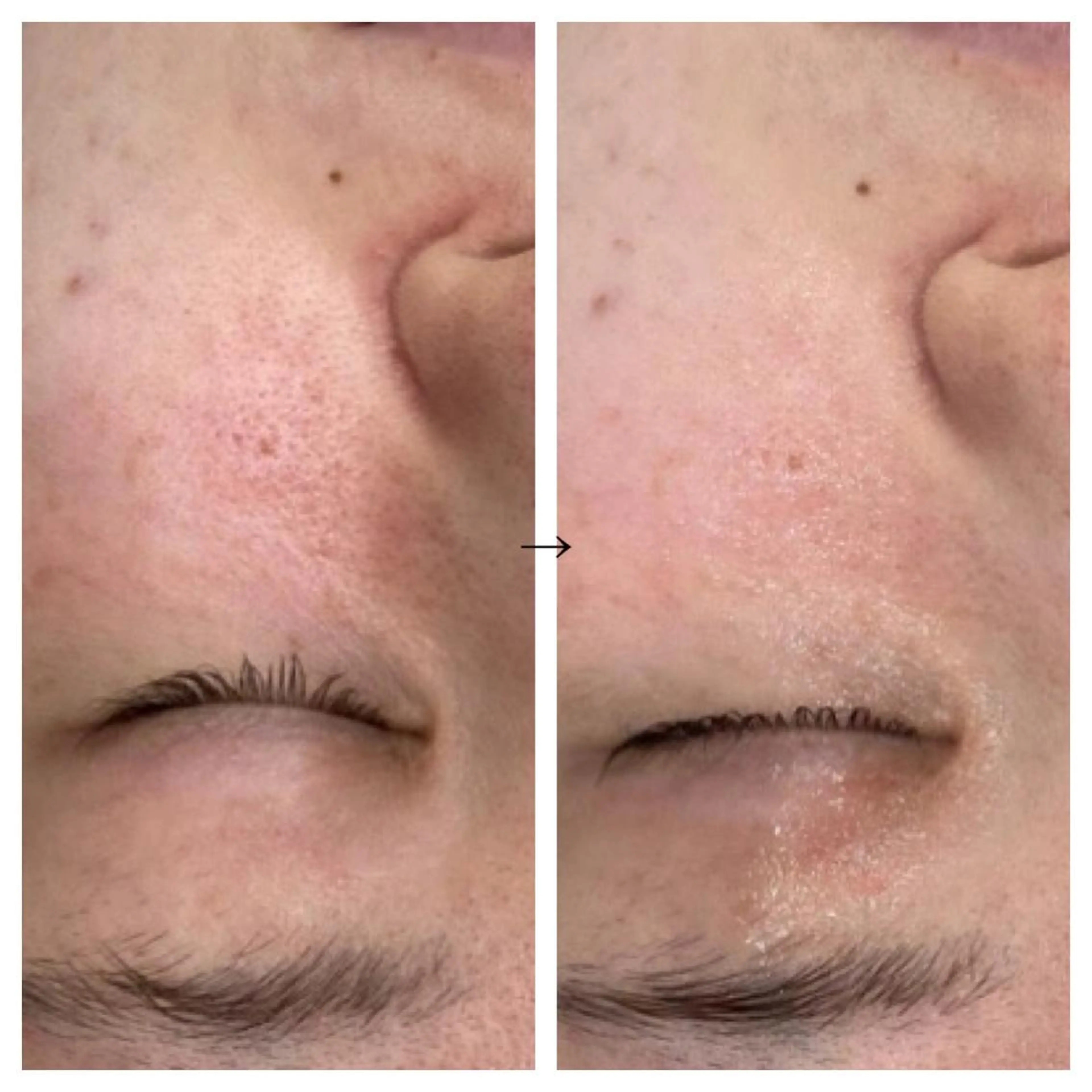 ビューティー ミロワールのエステ・リラクイメージ