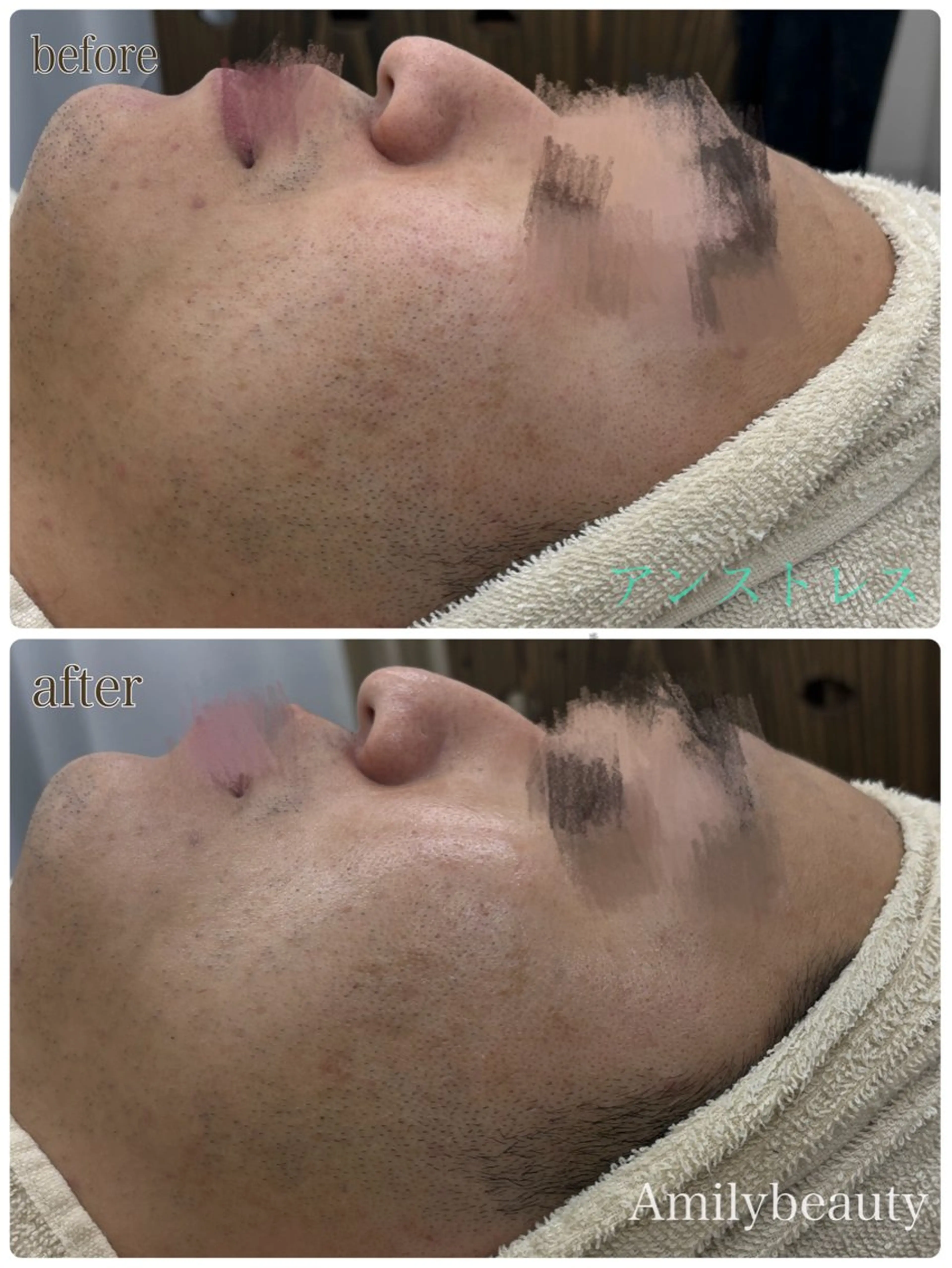 Amilybeauty所属・Amily beauty 毛利のその他イメージ