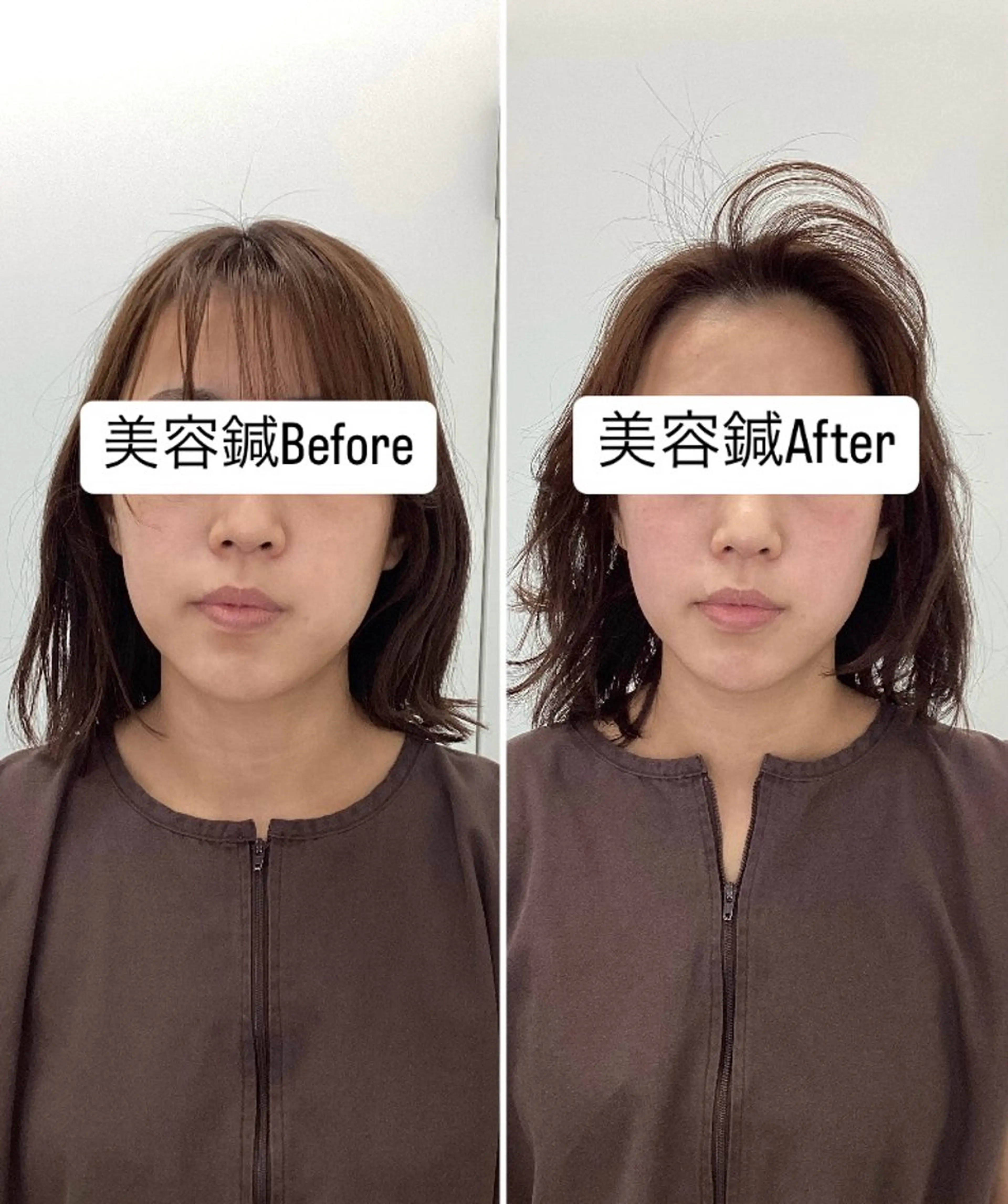 エステ リラク hari salon de off　美容鍼灸×小顔整体【ハリサロンドオフ】所属・美容鍼×小顔整体🤍 ishibashiのエステ・リラクイメージ