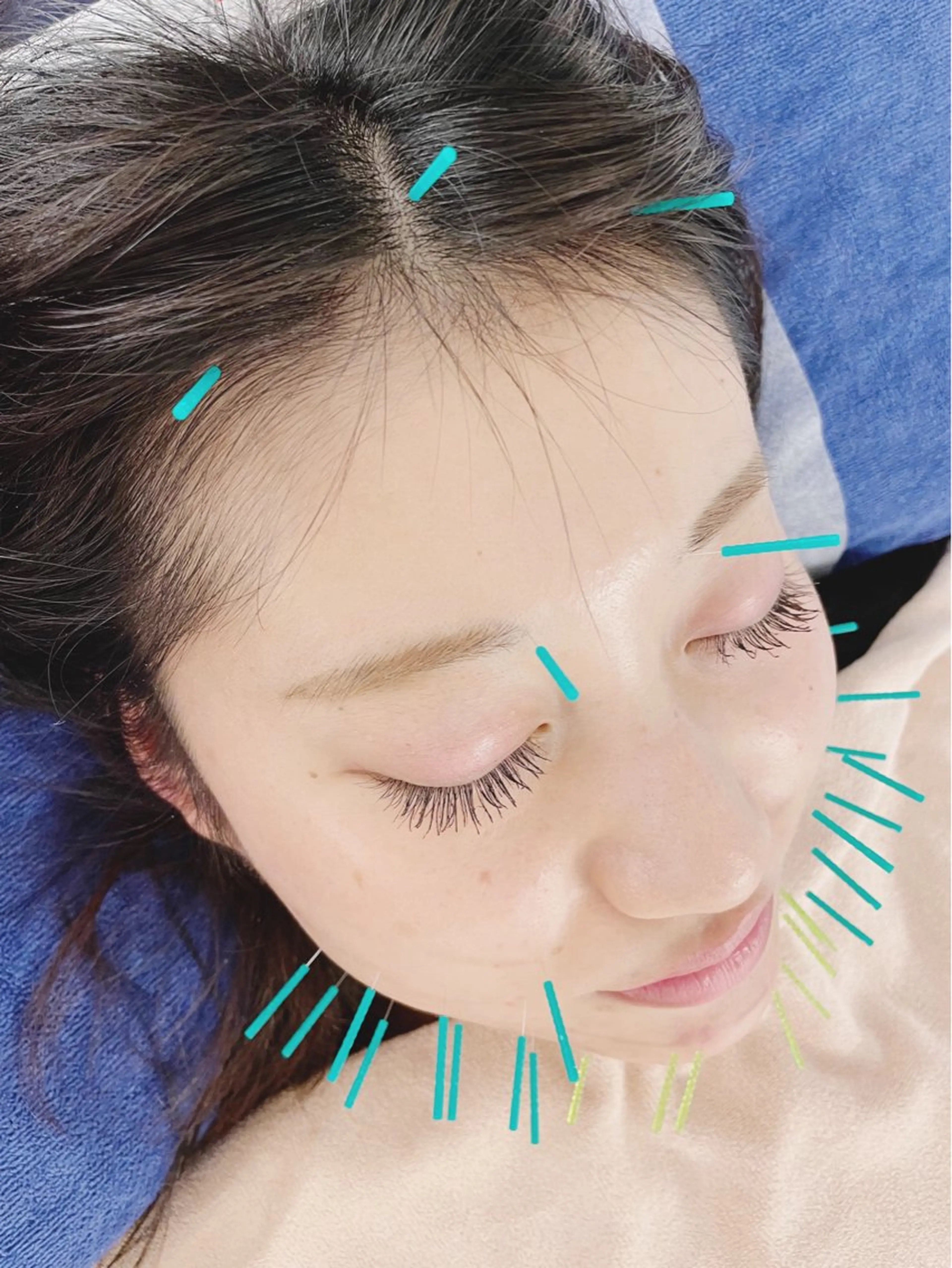 エステ リラク 小顔美容鍼専門サロン 渋谷YZのエステ・リラクイメージ