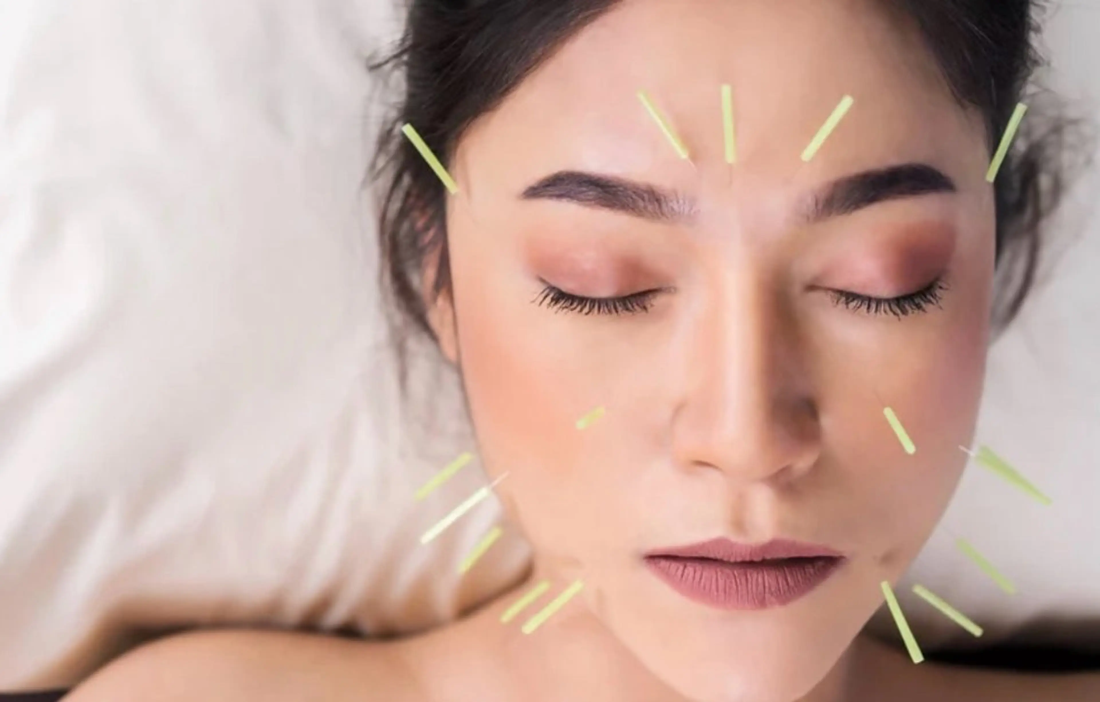 【　⭐︎Beauty  鍼灸　120分　】の写真