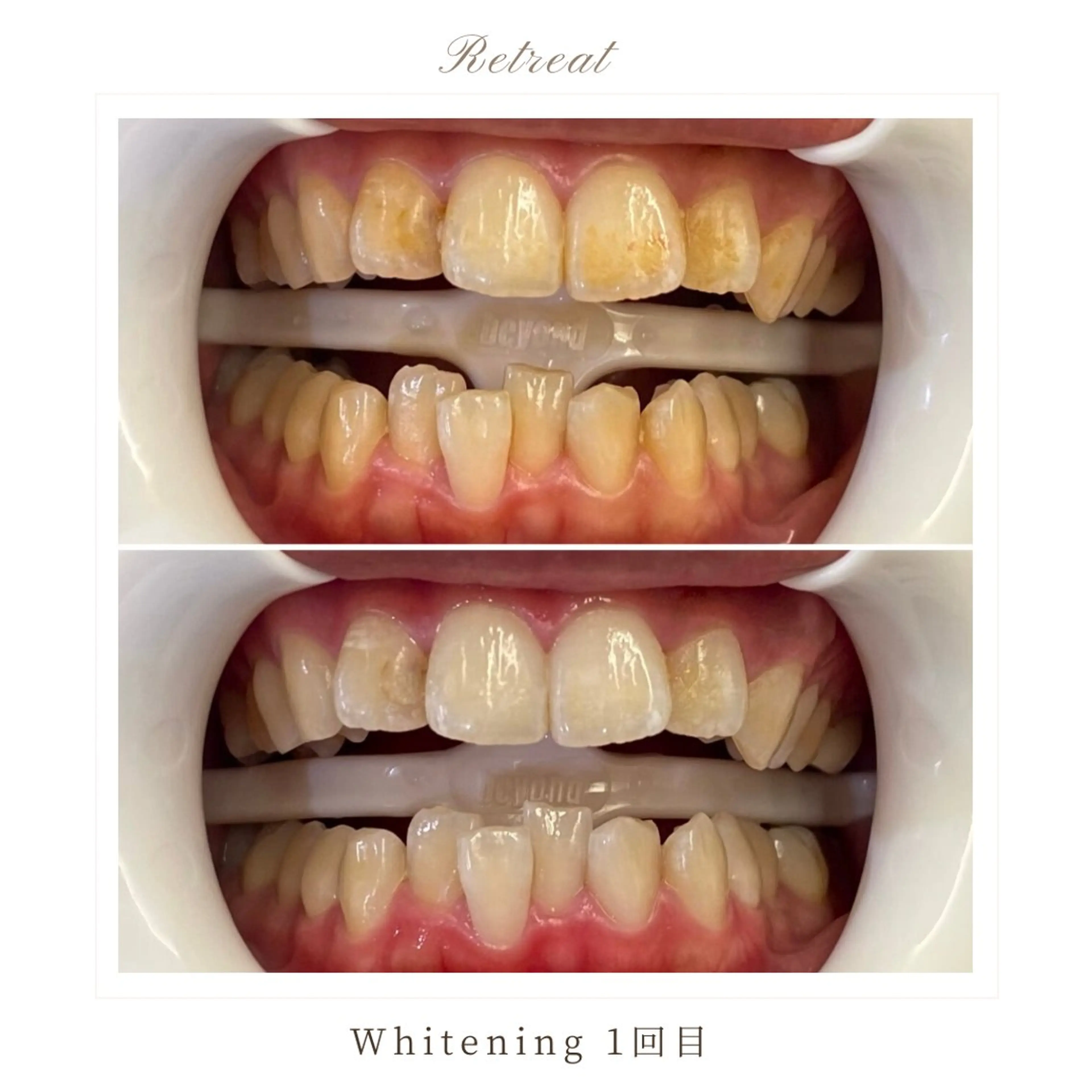 Retreatリトリート所属・歯科医院提携 Retreatのエステ・リラクイメージ