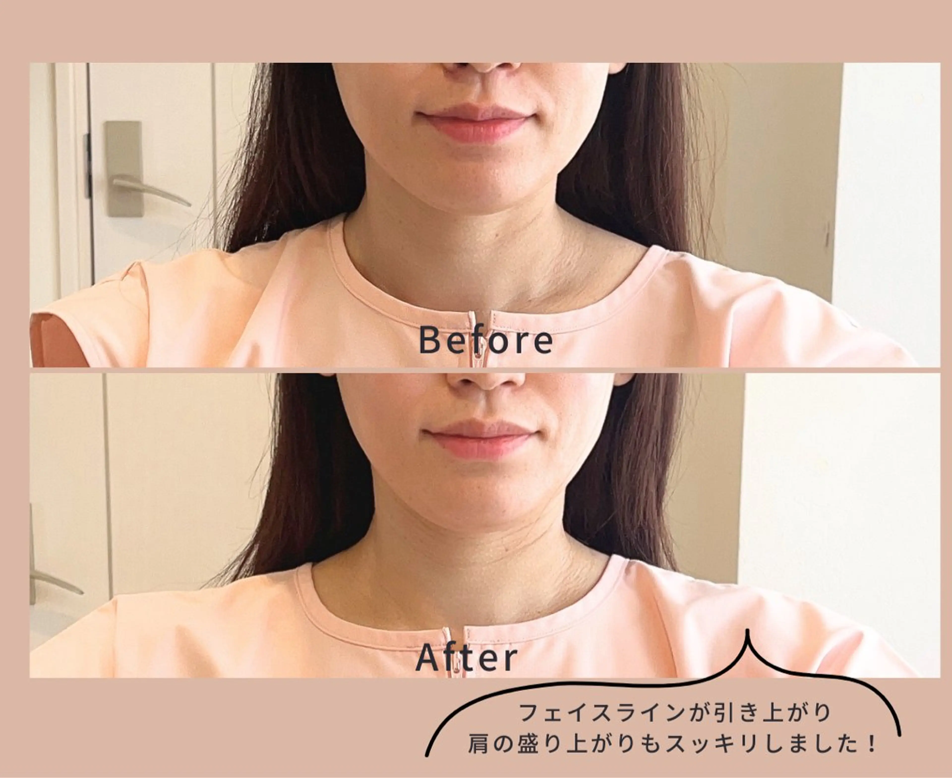 【初回限定】リフトアップしたい方に　速攻小顔コースの写真