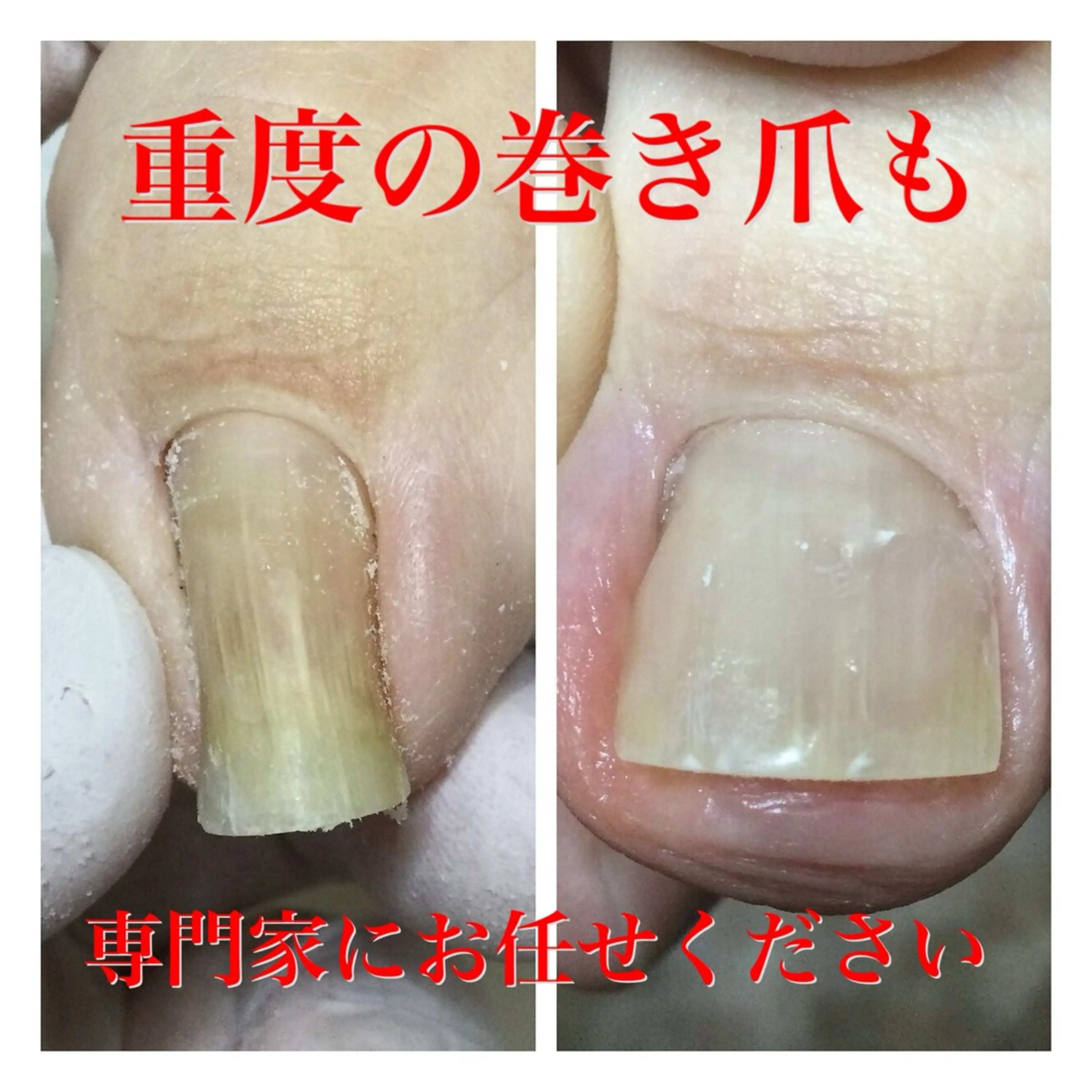 その他 ドクターネイル爪革命 takahashiのその他イメージ