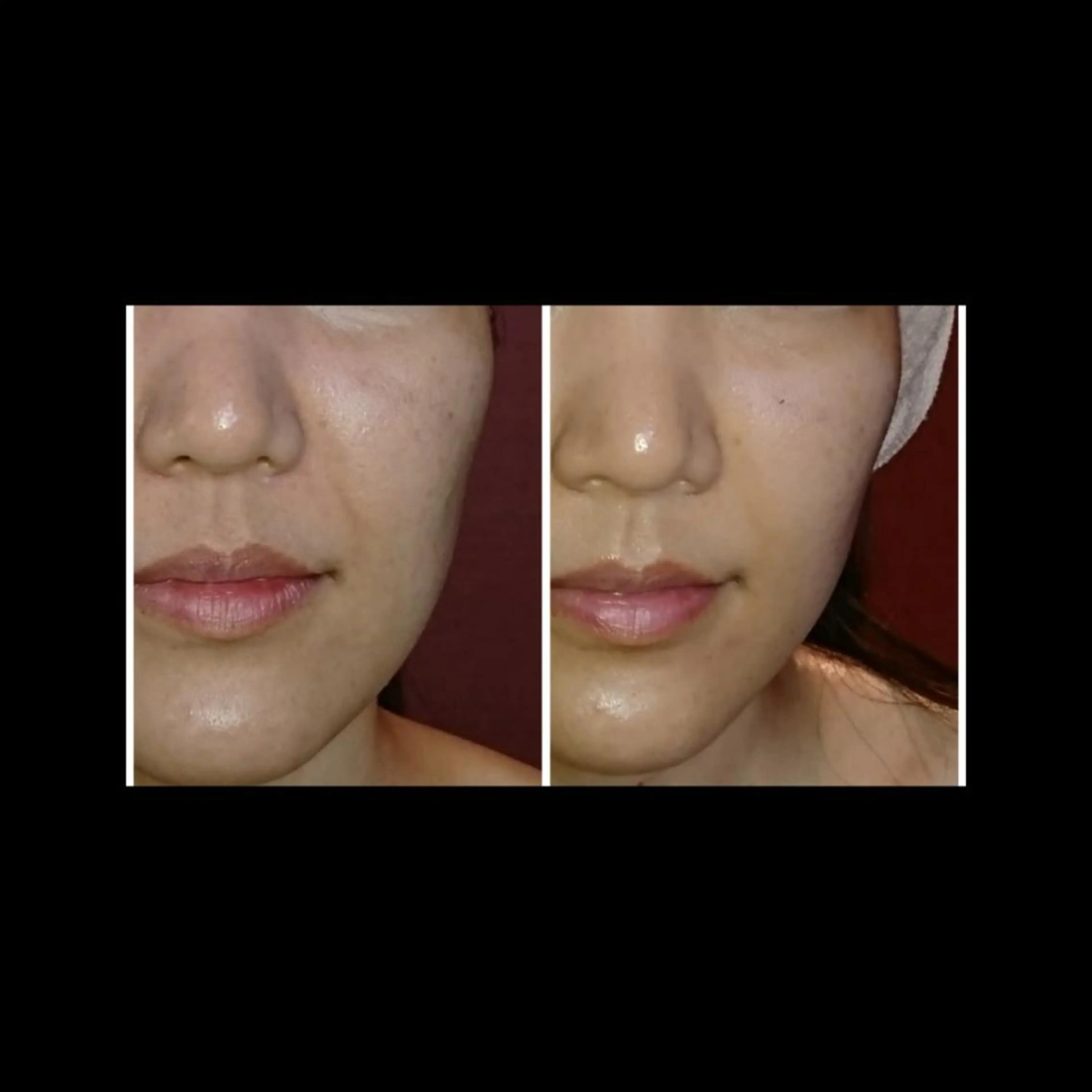 エステ リラク Nako ナコのエステ・リラクイメージ