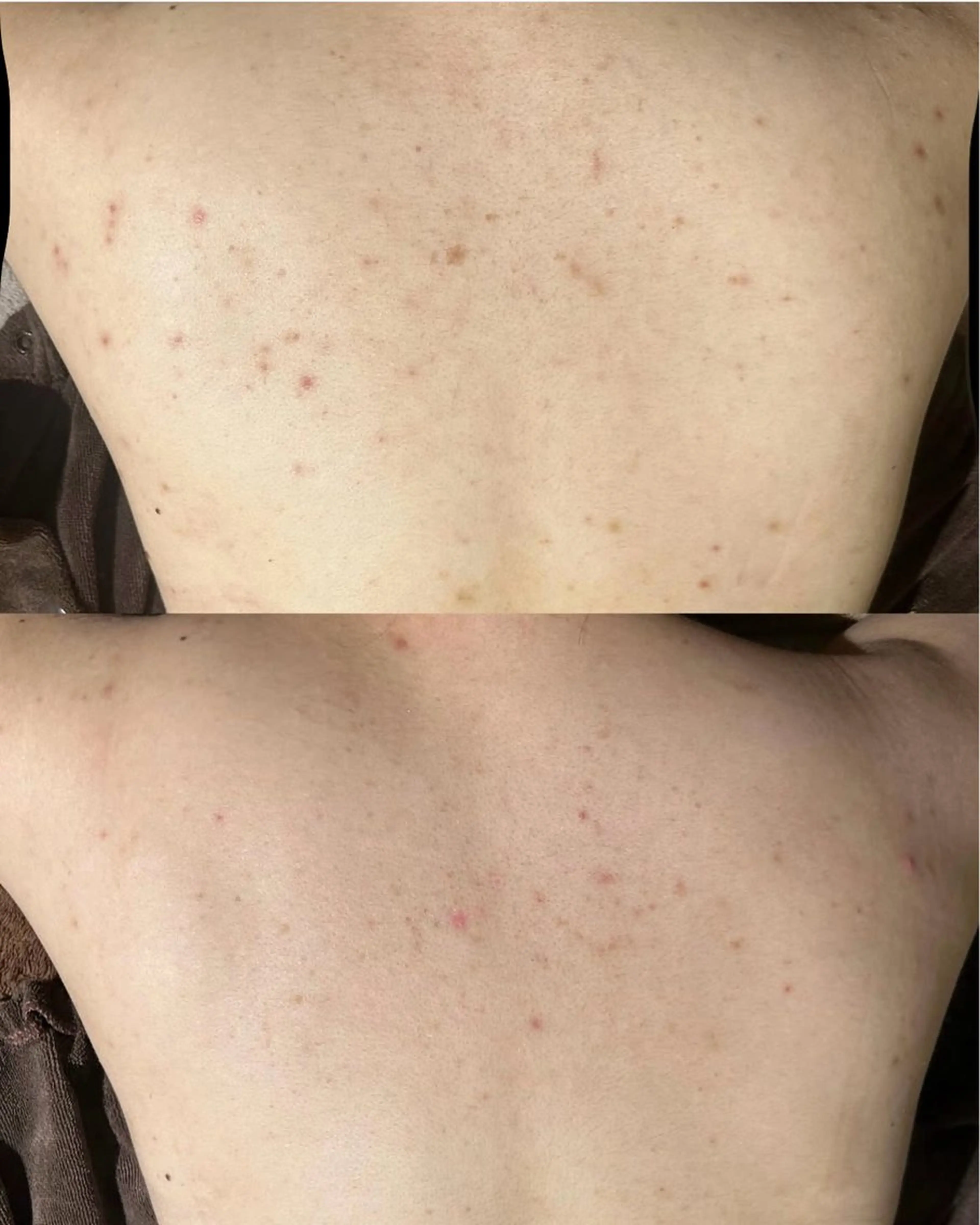 エミルカ　自由が丘店所属・花島 悠のエステ・リラクイメージ