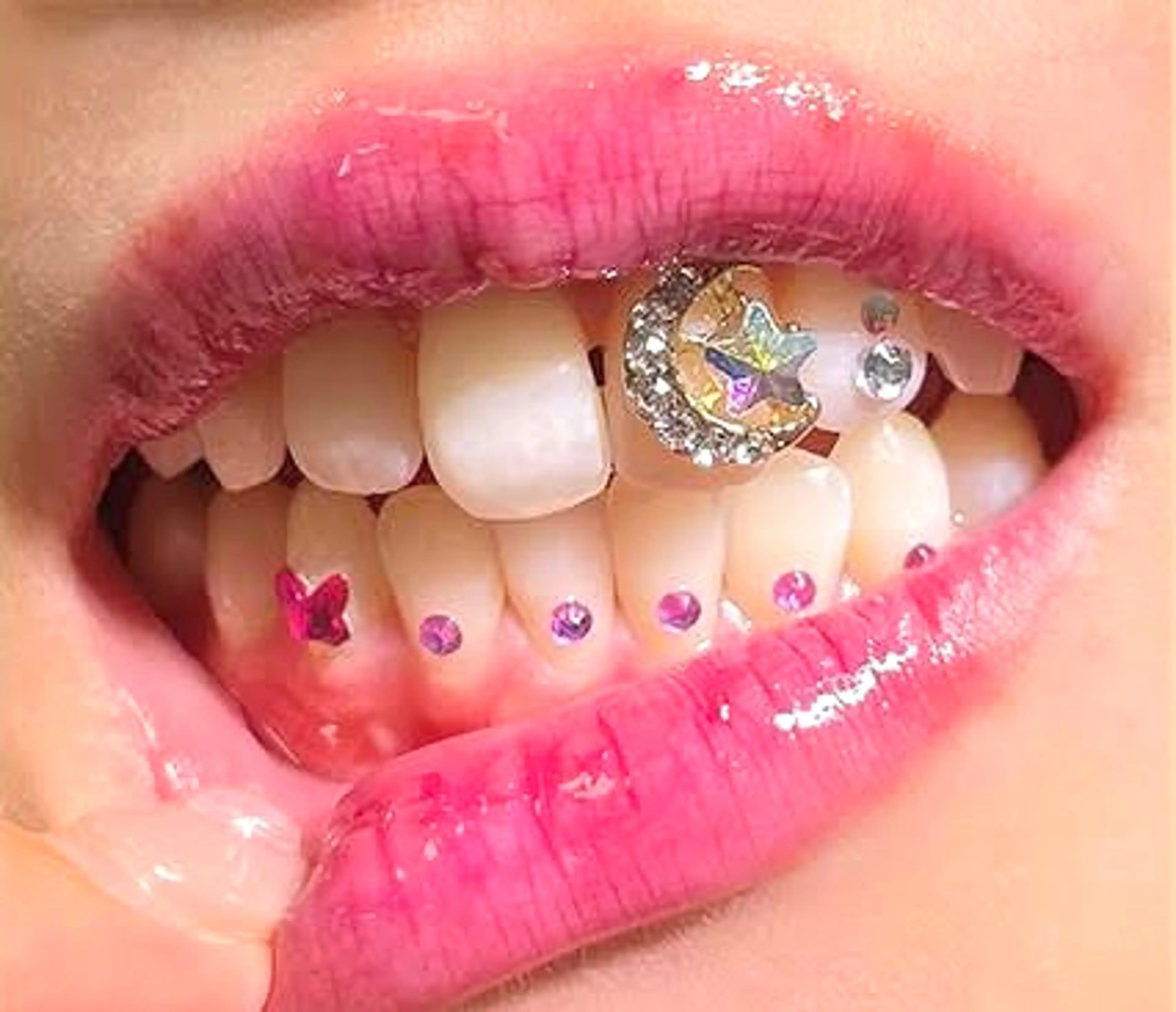 その他 ホワイトニングショップ伊丹店所属・ホワイトニング ショップ伊丹店のその他イメージ