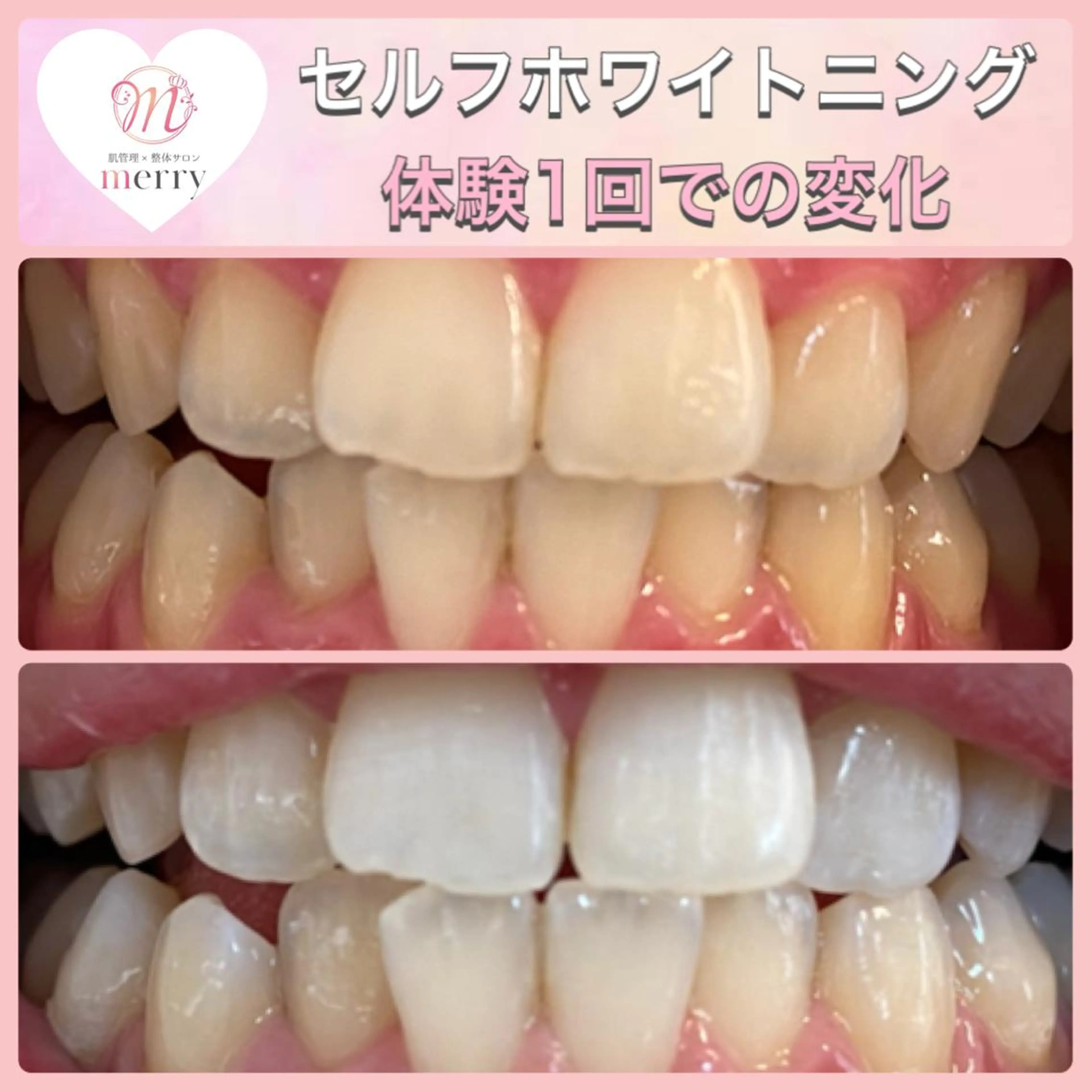 肌管理×整体サロンmerry所属・merry スタッフのその他イメージ