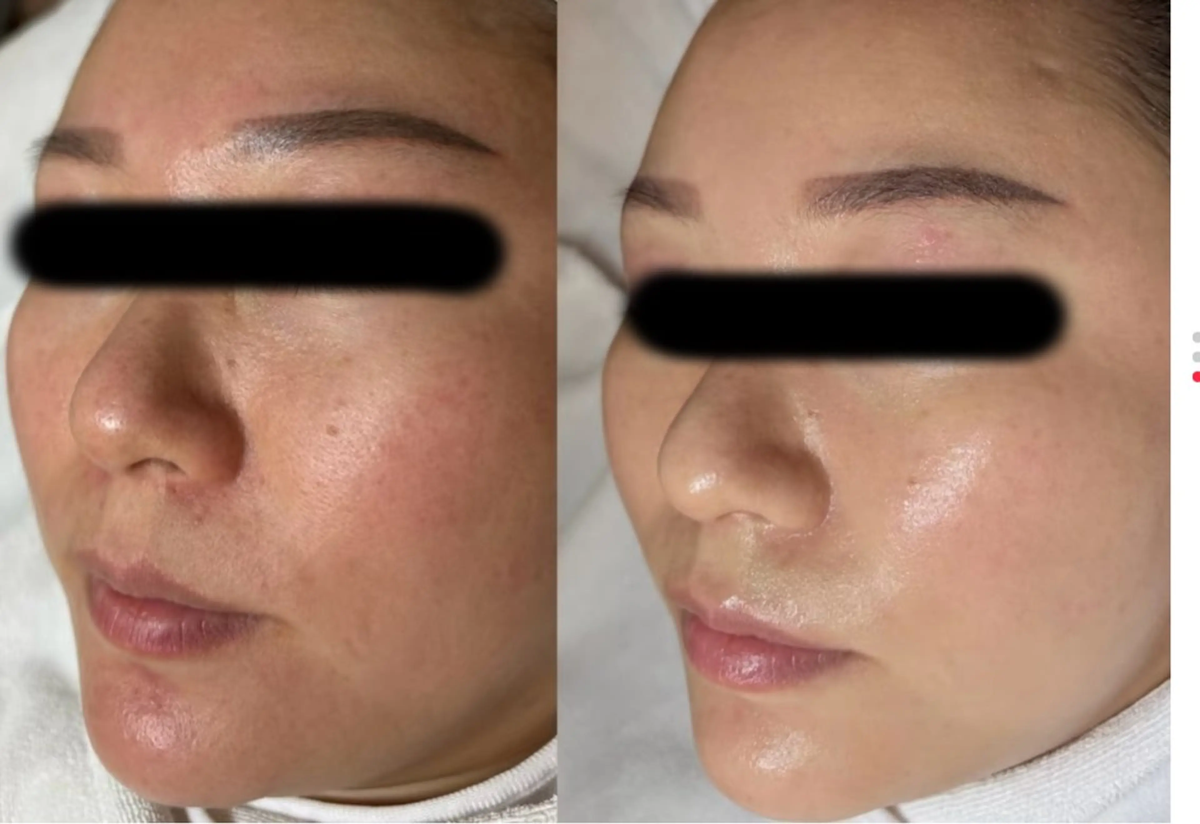 MONICAビューティサロン所属・MONICAサロン ⭐︎フェイシャル痩身のエステ・リラクイメージ