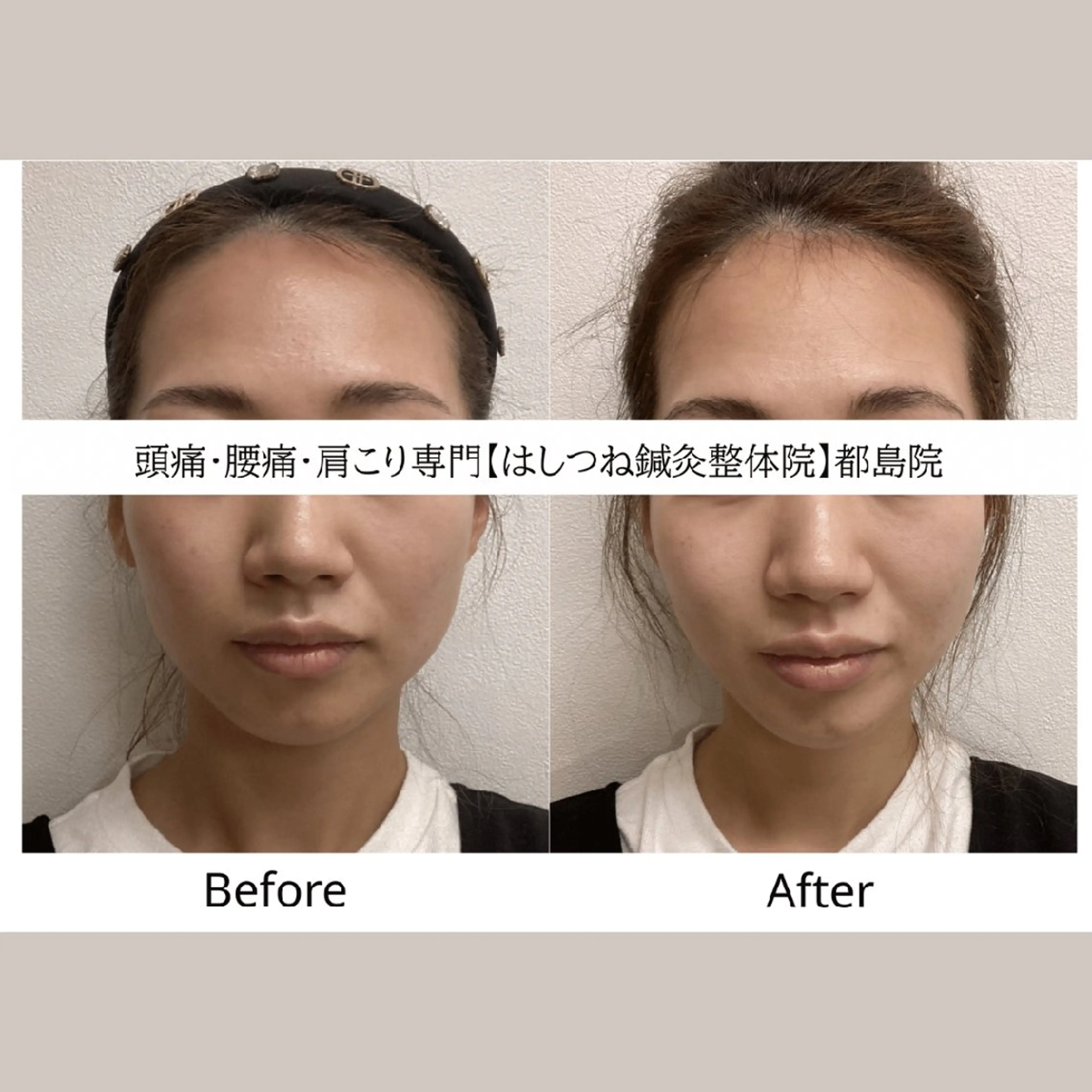 頭痛・腰痛・肩こり 特化してます。　橋岡のエステ・リラクイメージ