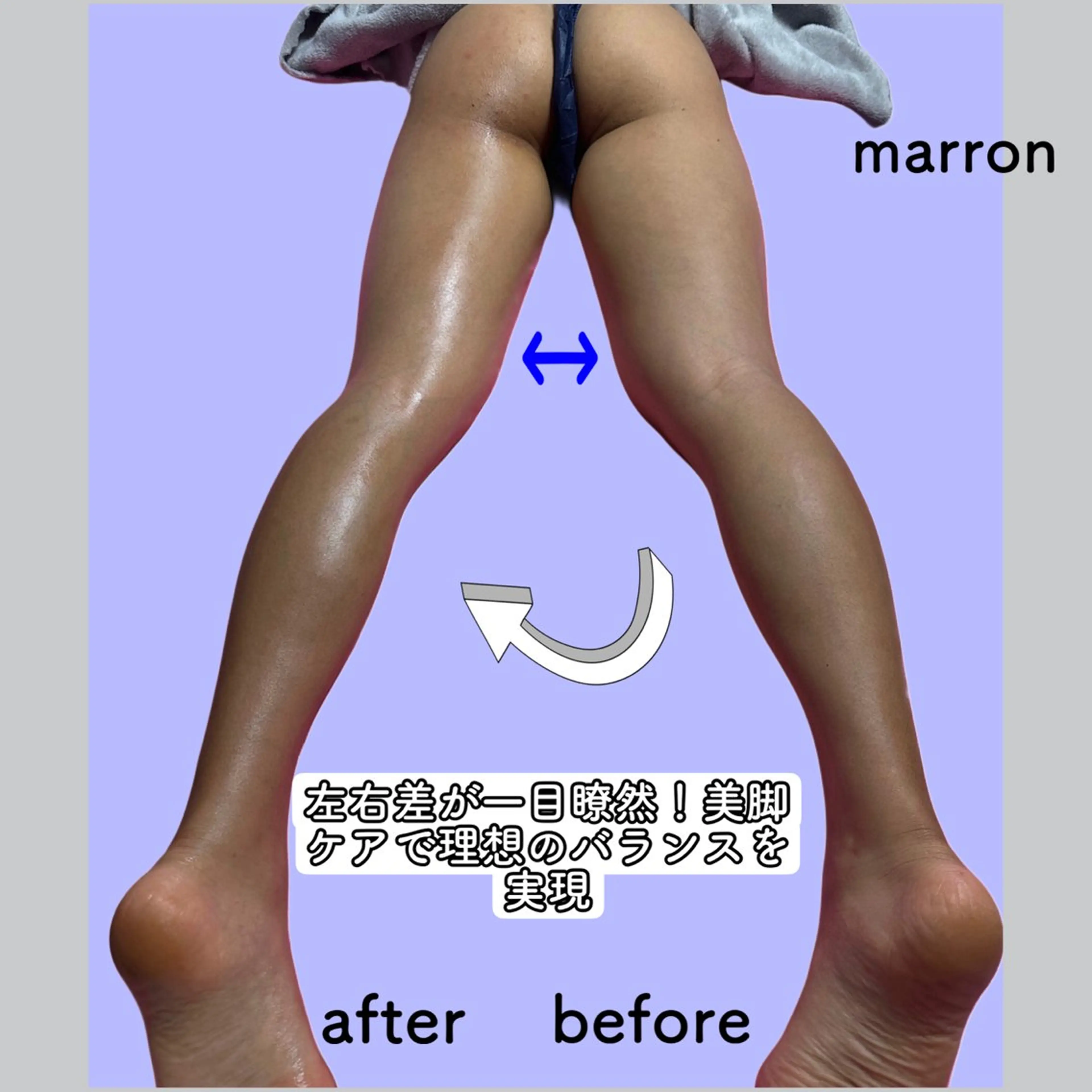 marron所属・痩身ハイパーナイフ ララピールリアボーテのエステ・リラクイメージ