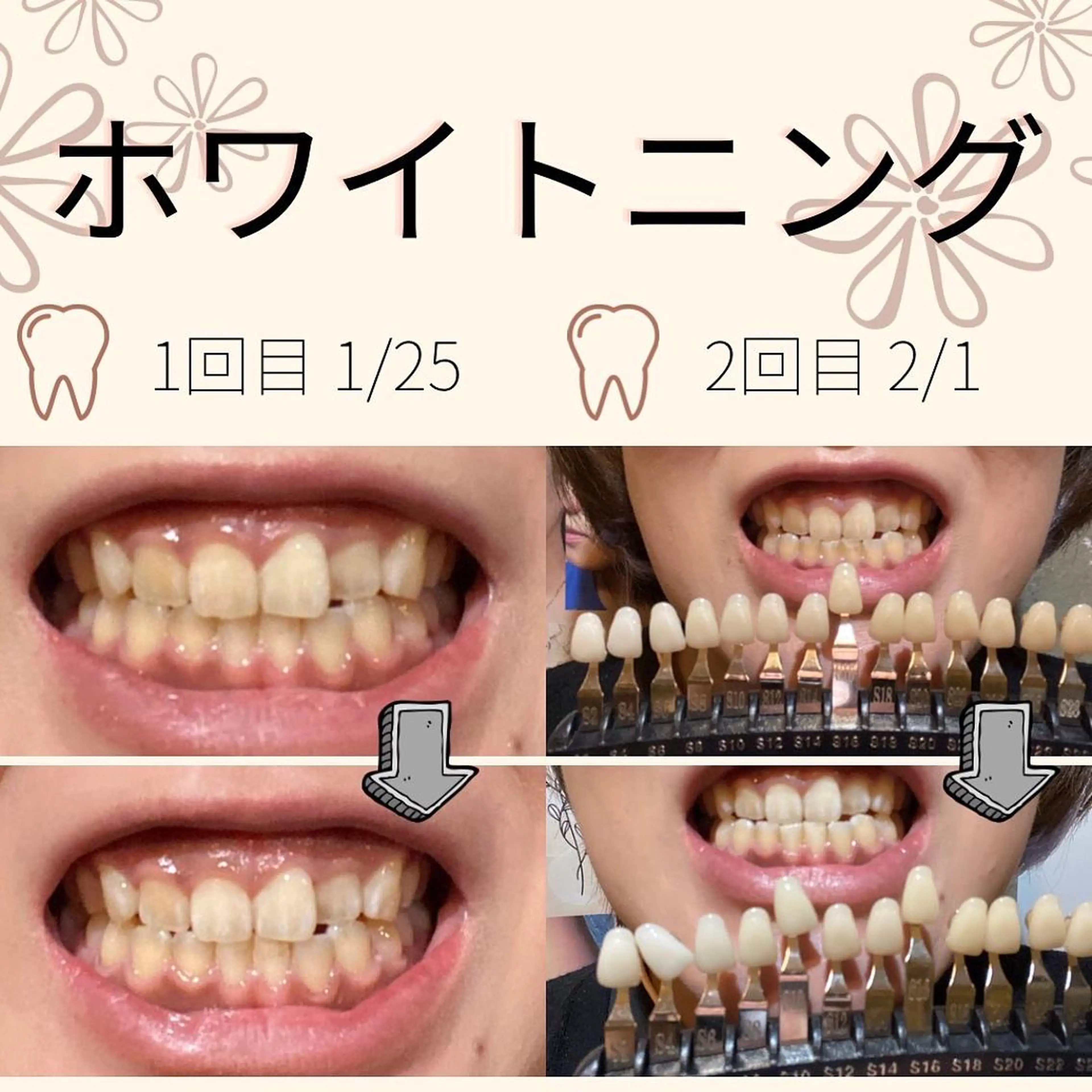 メンズ 男女同額完全個室脱毛 LEPIA内田のエステ・リラクイメージ