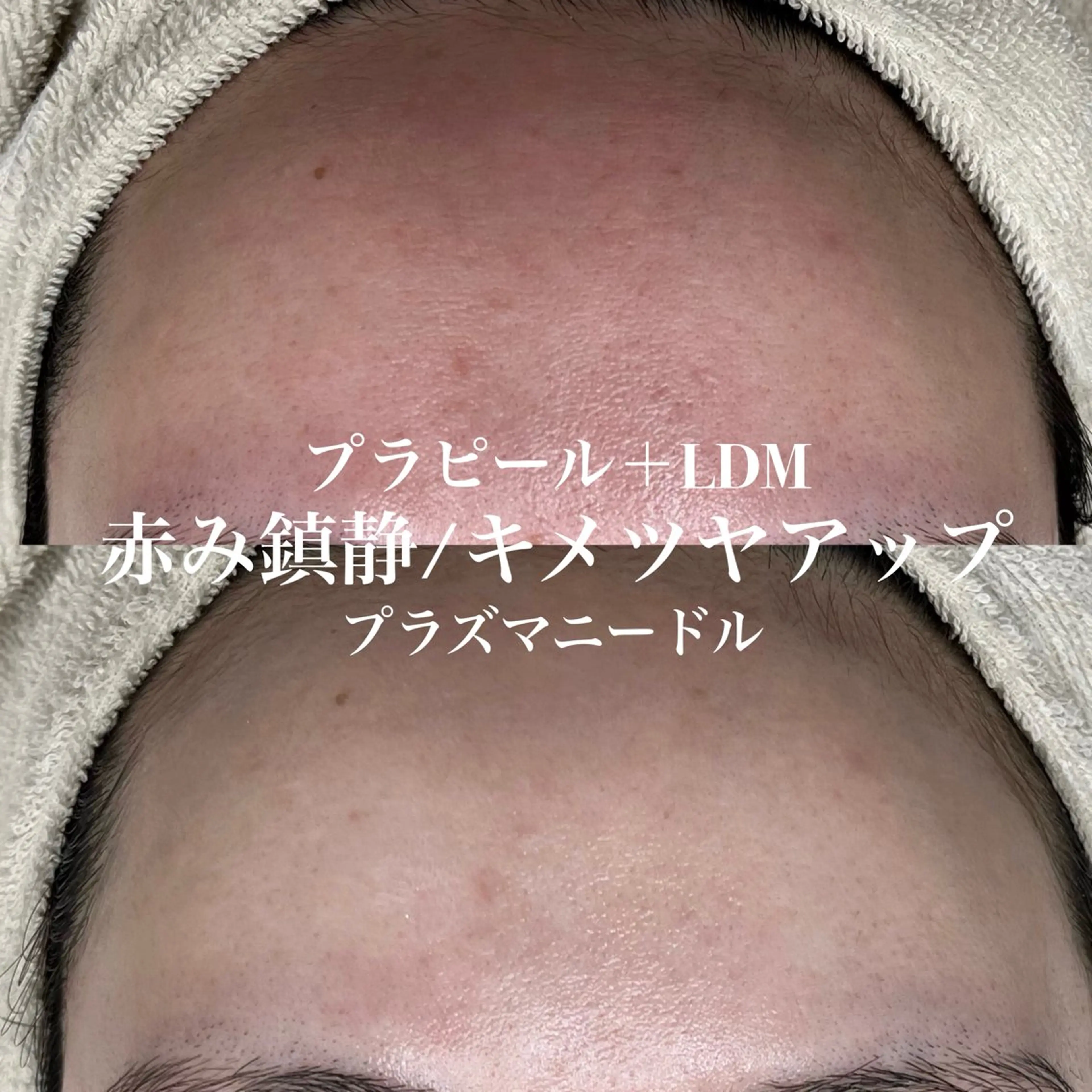 韓国肌管理&小顔 ＩＲＯＨＡのエステ・リラクイメージ