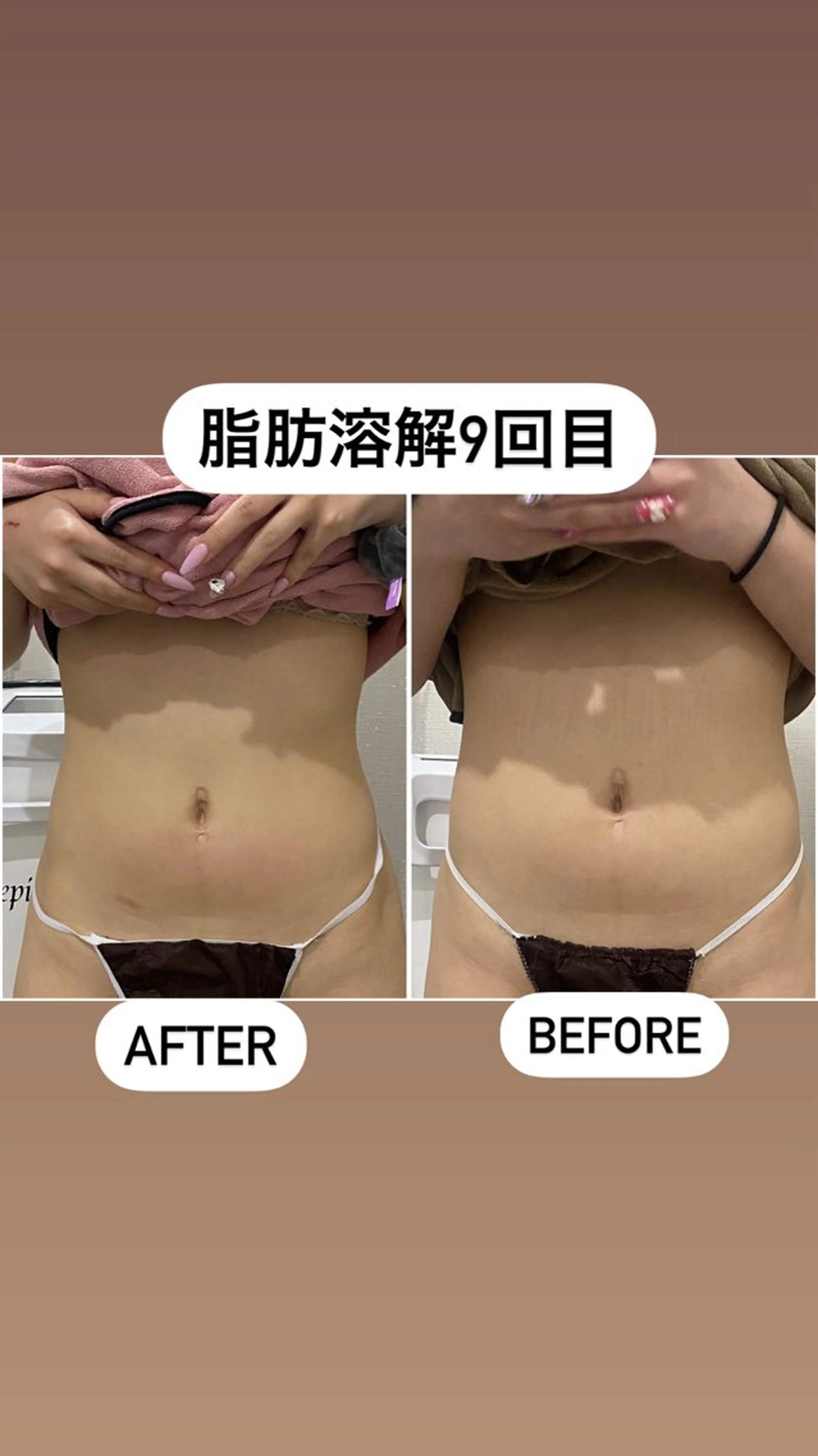 エステ 毛穴洗浄・痩身・脱毛 /アルカンジュのエステ・リラクイメージ