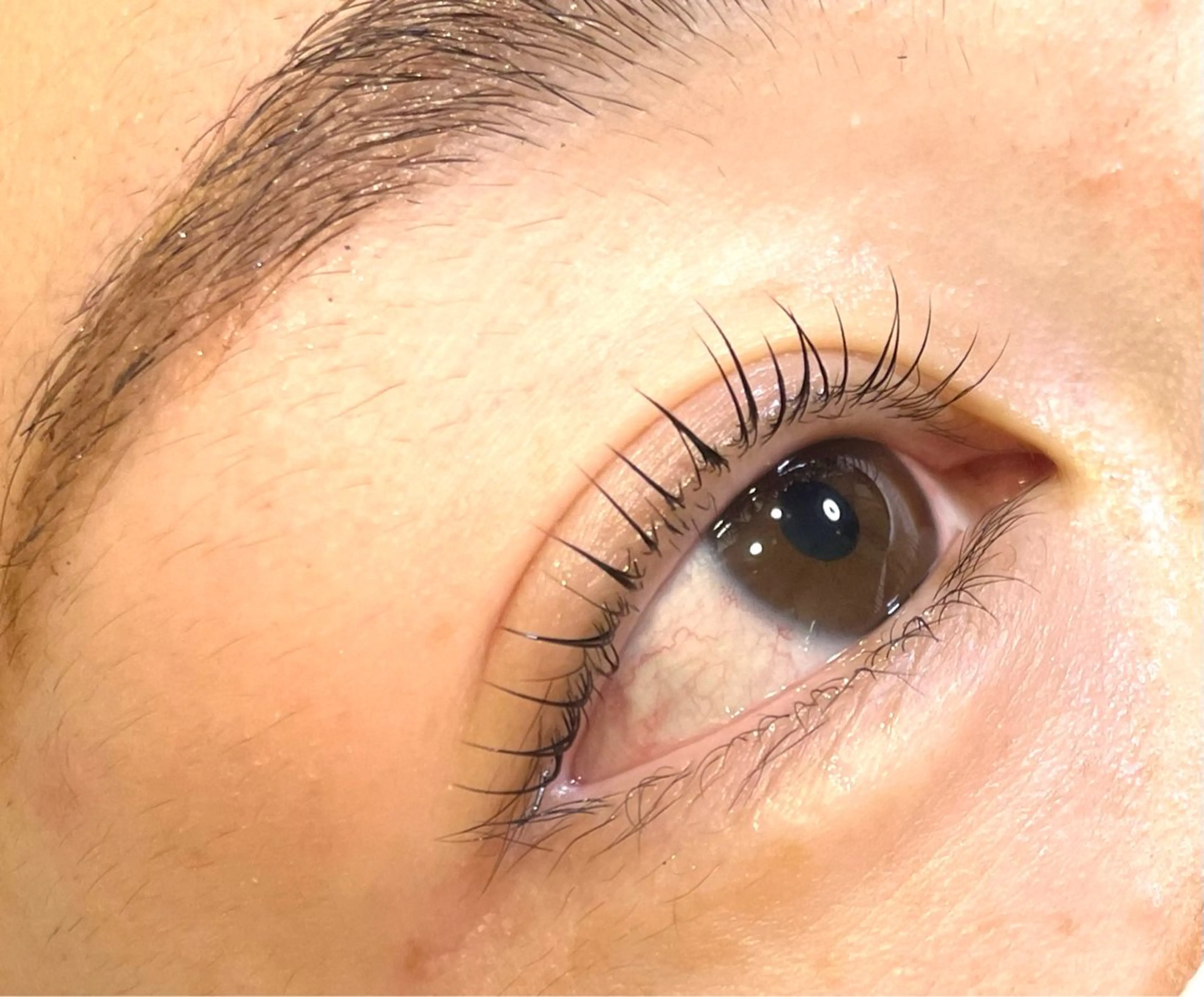 マツパ＋ケラチントリートメント付きの写真