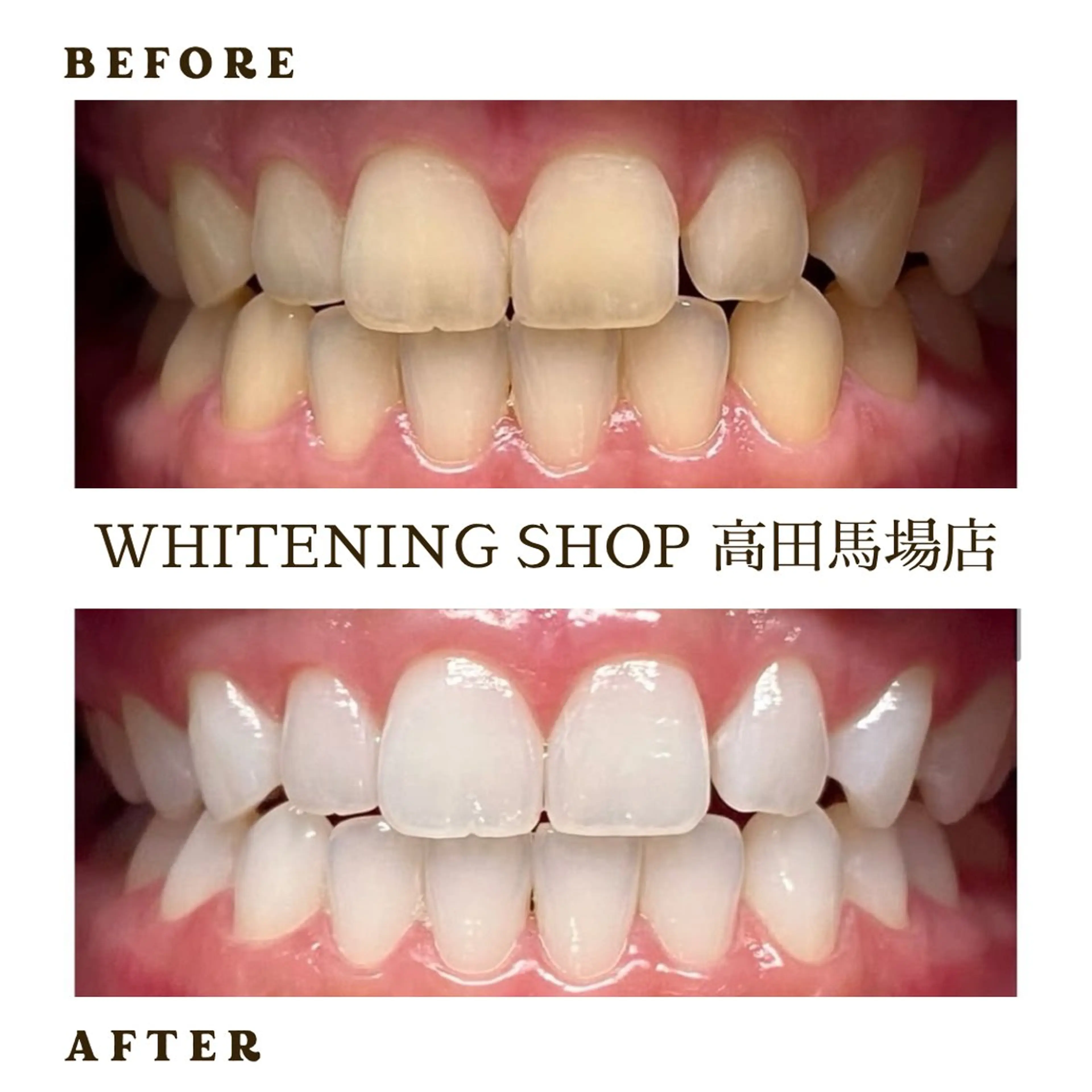 メンズ その他 ホワイトニング ショップ高田馬場店のその他イメージ