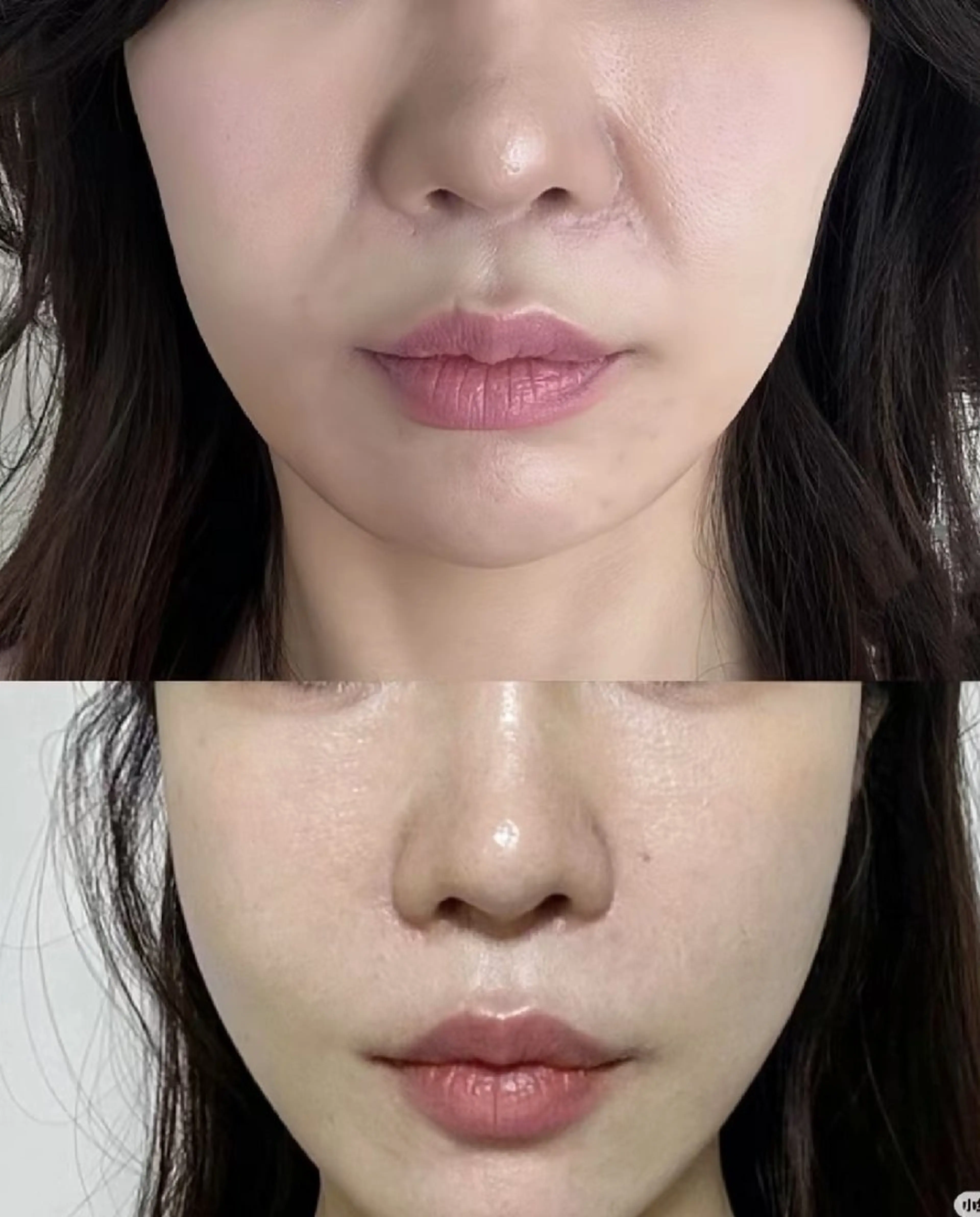 マツエク・マツパ 結婚式・ブライダル aliaハイフ&水光ジェットサロン所属・aliaハーブ水光店 エステティシャン募集のエステ・リラクイメージ