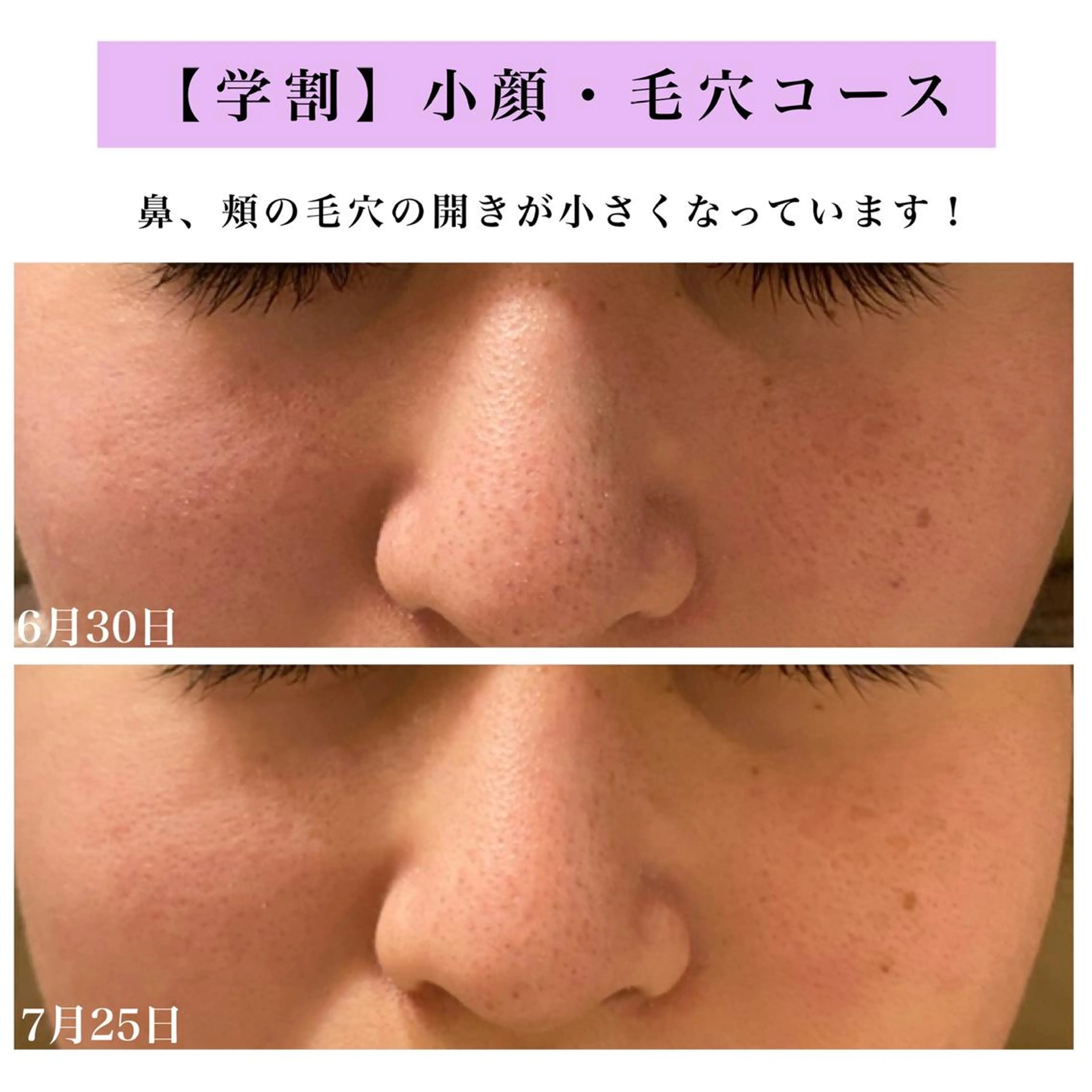 Bellesthe （ベルエステ）のエステ・リラクイメージ