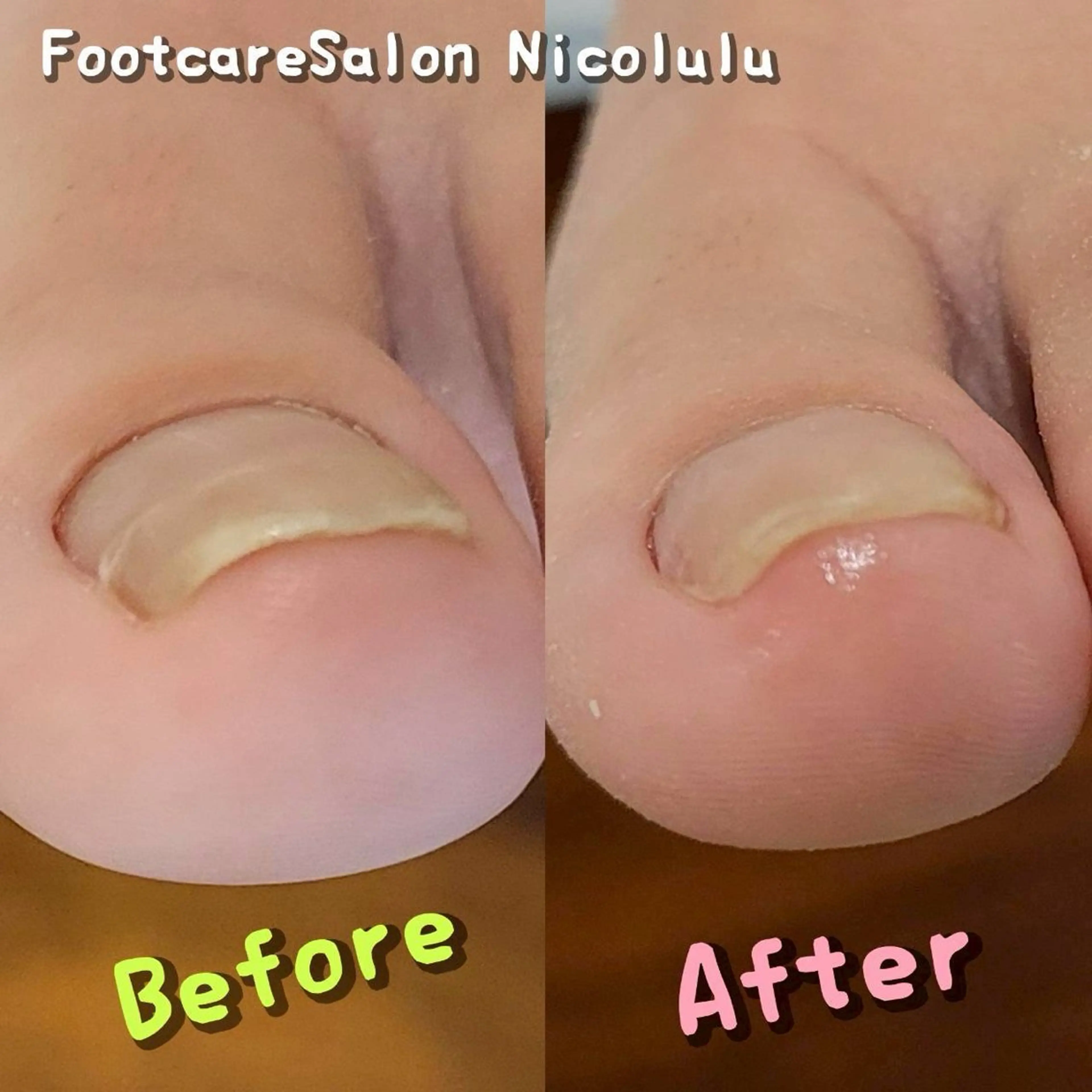 リラク 足トラブル専門 ニコルル金沢のエステ・リラクイメージ