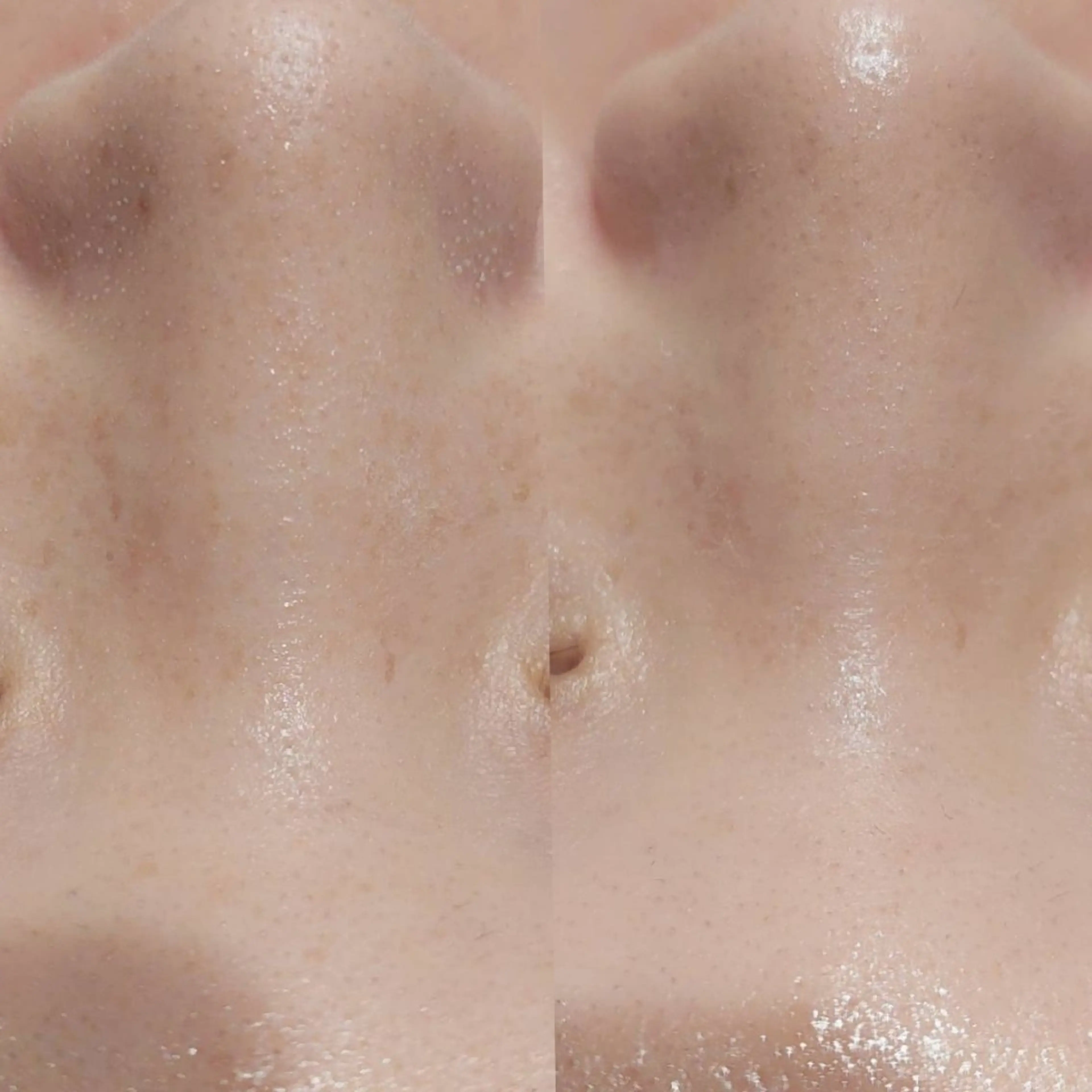 MyFairLady miuのエステ・リラクイメージ