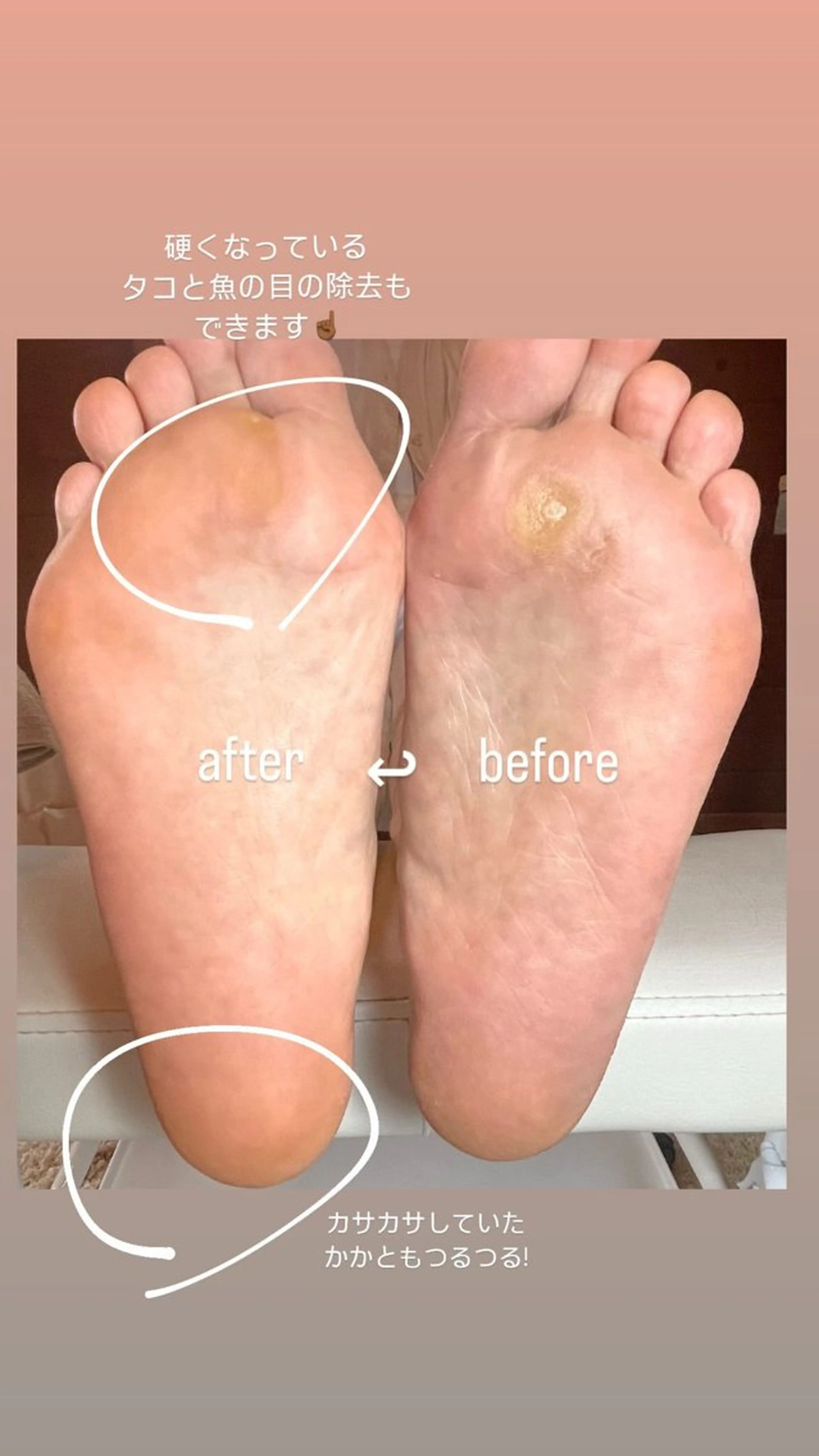 もちふわフットケアコース🦶🏻✨の写真