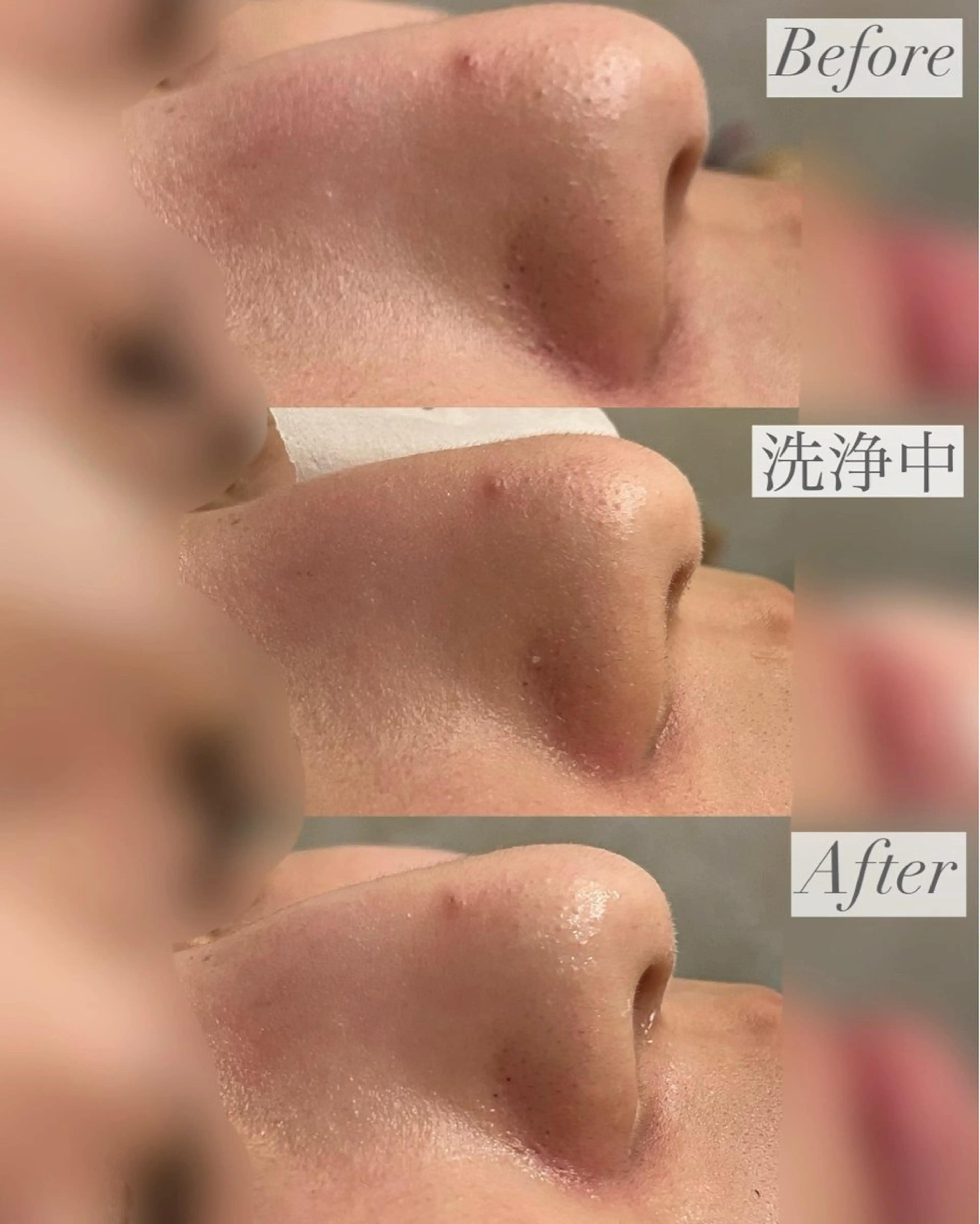 emiluca西目/ 毛穴洗浄/細胞美容のエステ・リラクイメージ