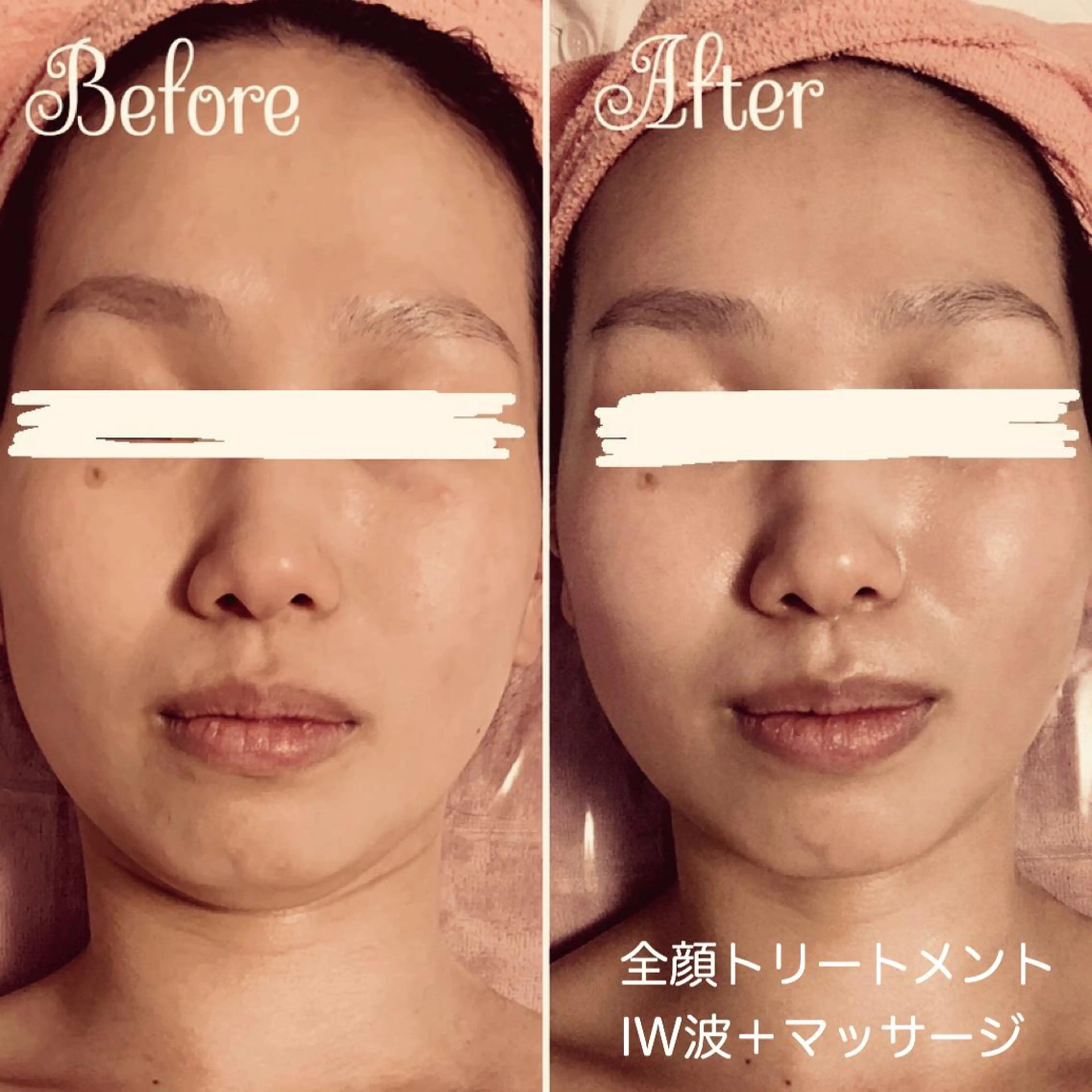 エステ リラク 透明感の肌Lino malieのエステ・リラクイメージ