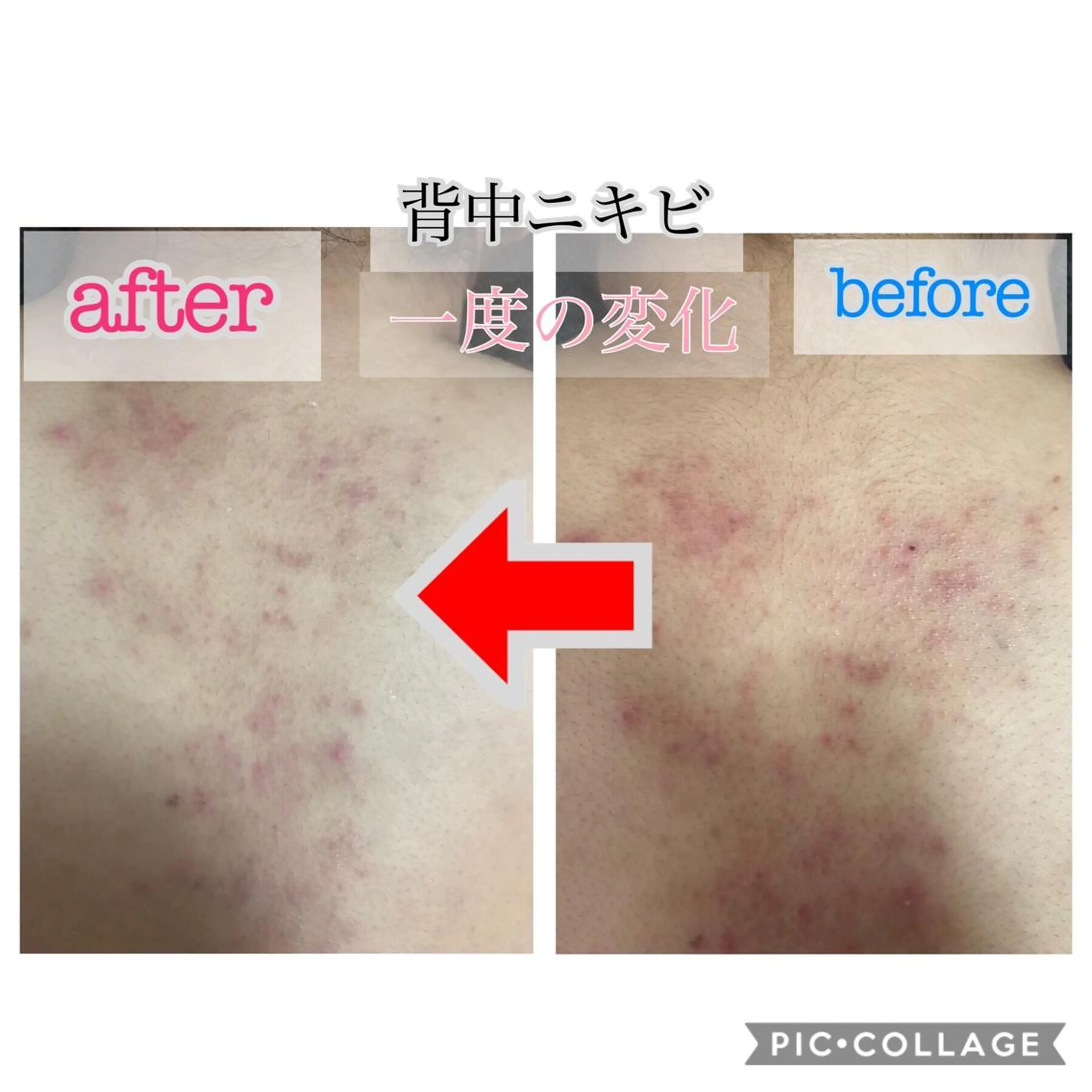 ミディアム カラー パーマ ヘアアレンジ メンズ キッズ ネイル マツエク・マツパ 四つ星サロン🎖 腸＆ニキビケアに特化のエステ・リラクイメージ