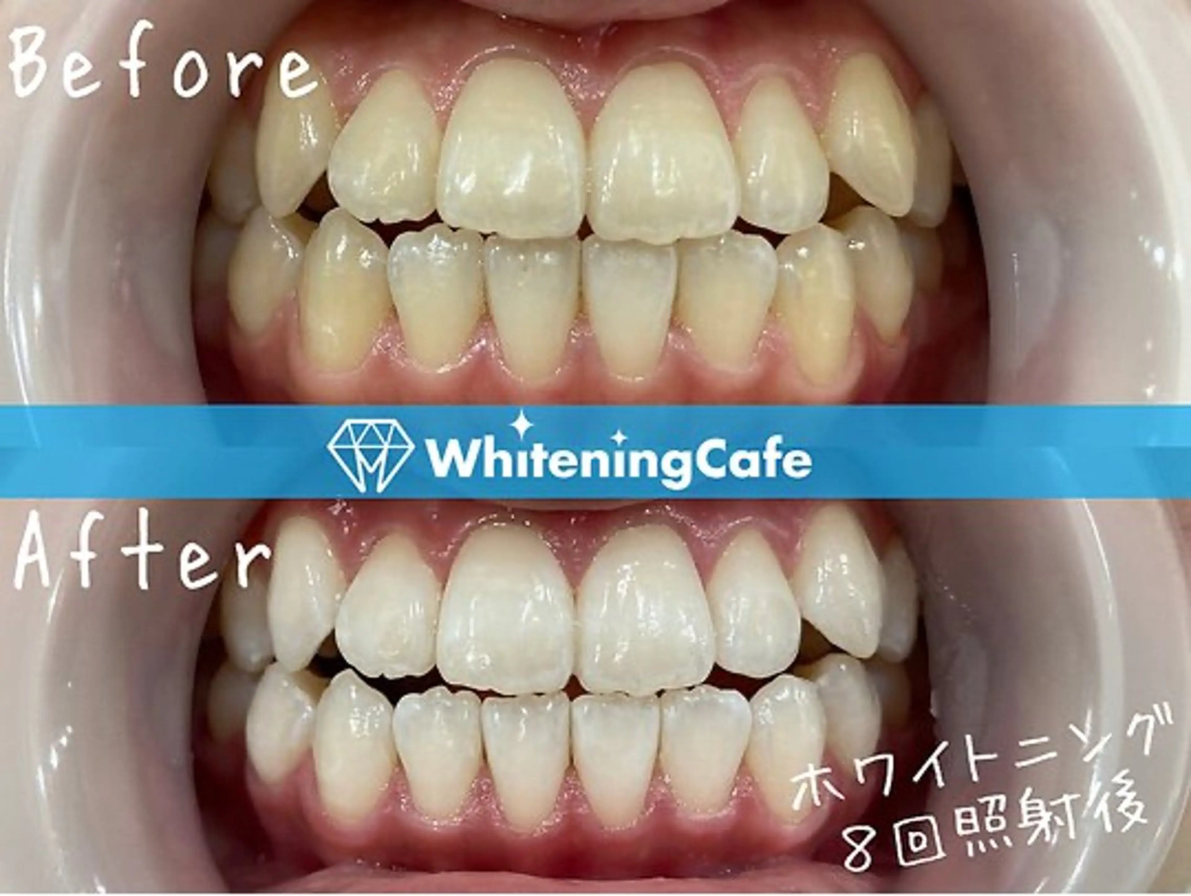 ホワイトニングカフェ荻窪店所属・ホワイトニングカフェ 荻窪店のその他イメージ