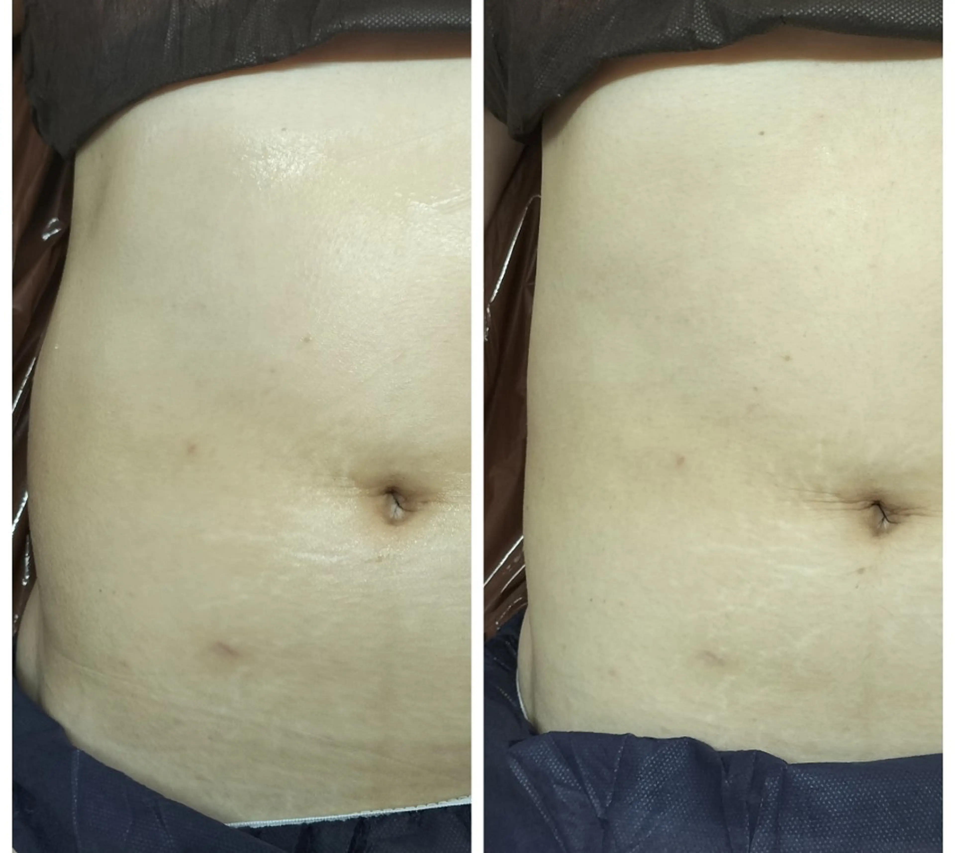 結果出し！最新機器で気になる部分ケアの写真