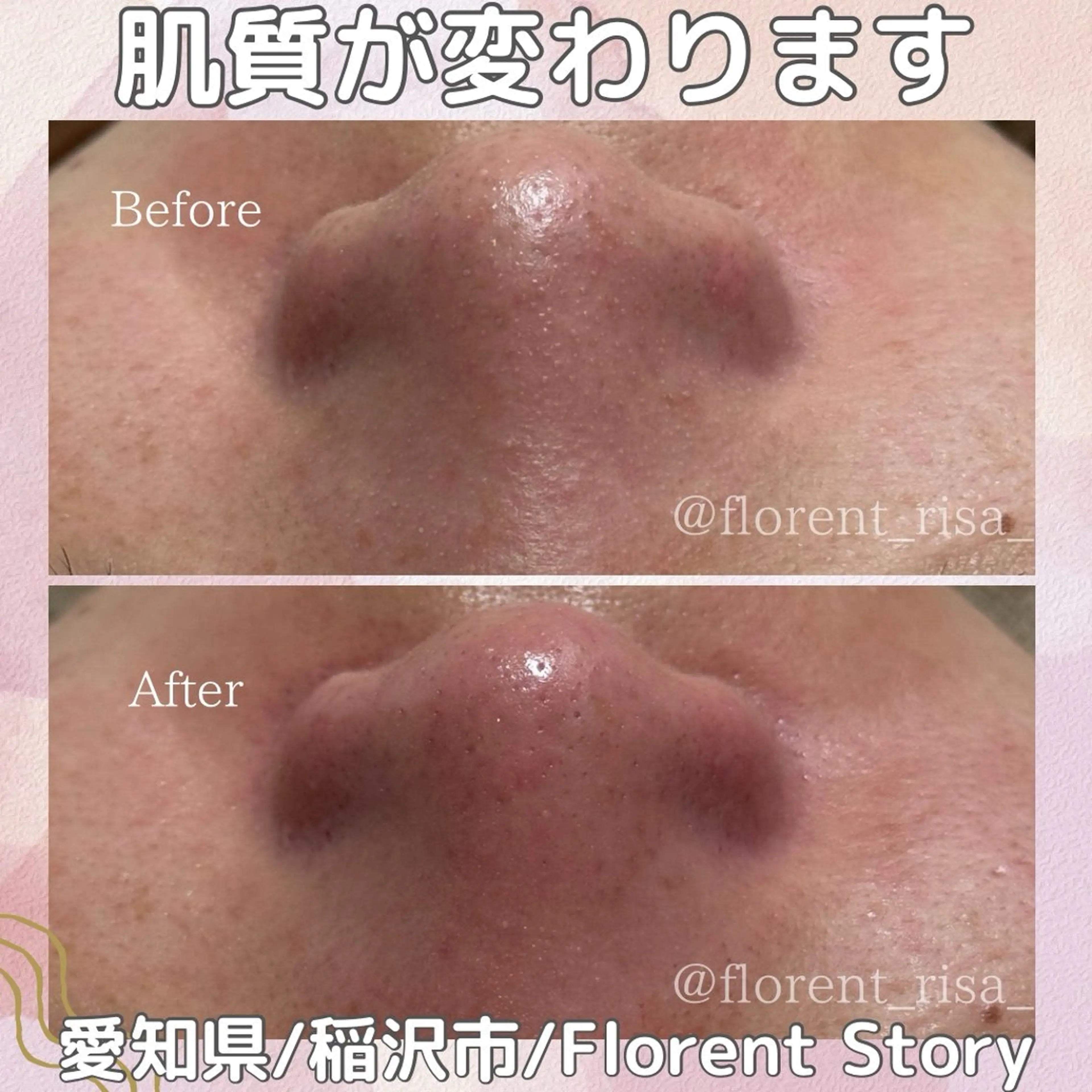 エステ 田中 里沙のエステ・リラクイメージ