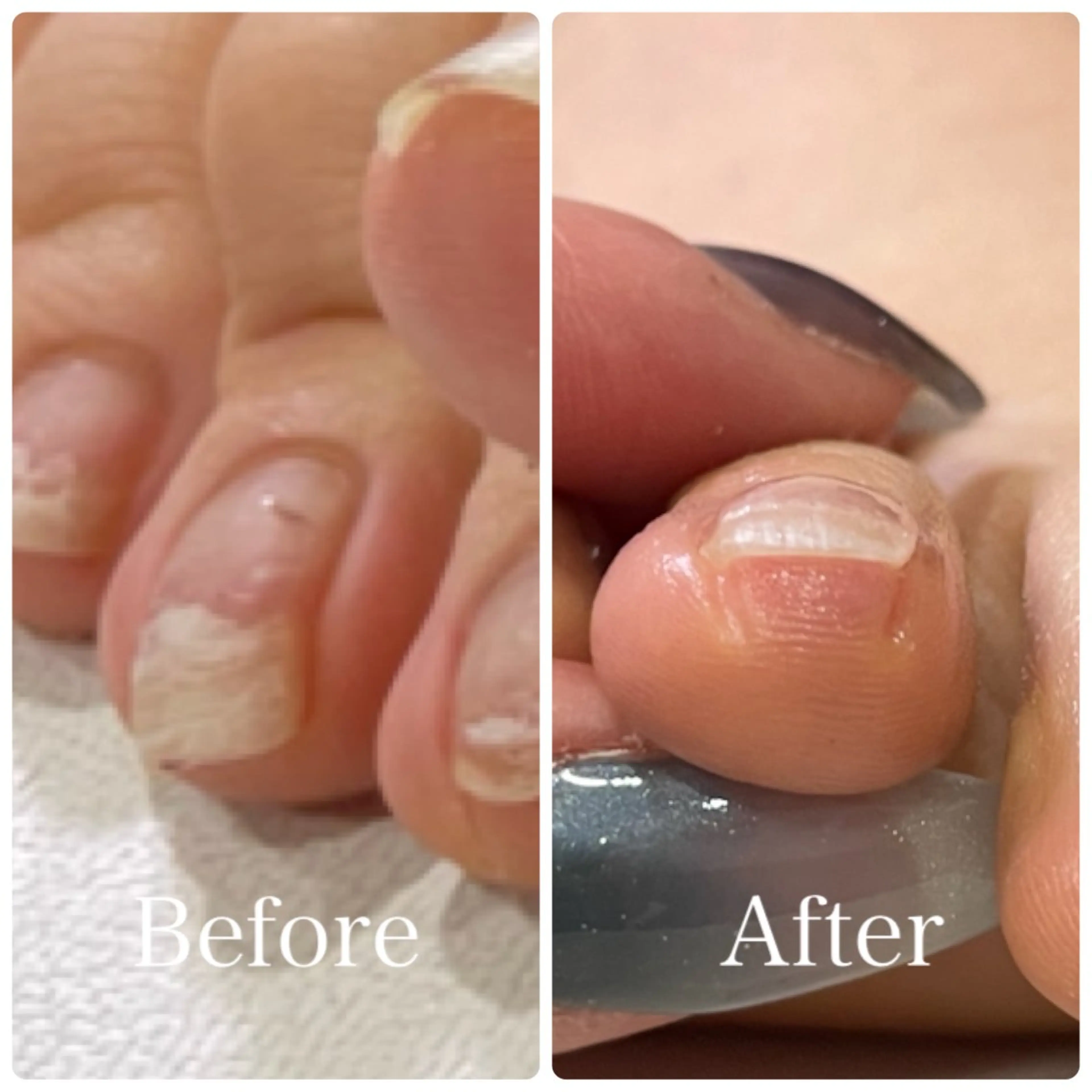 ネイル Private Nail Salon OK所属・FUKA ♡のネイルデザイン