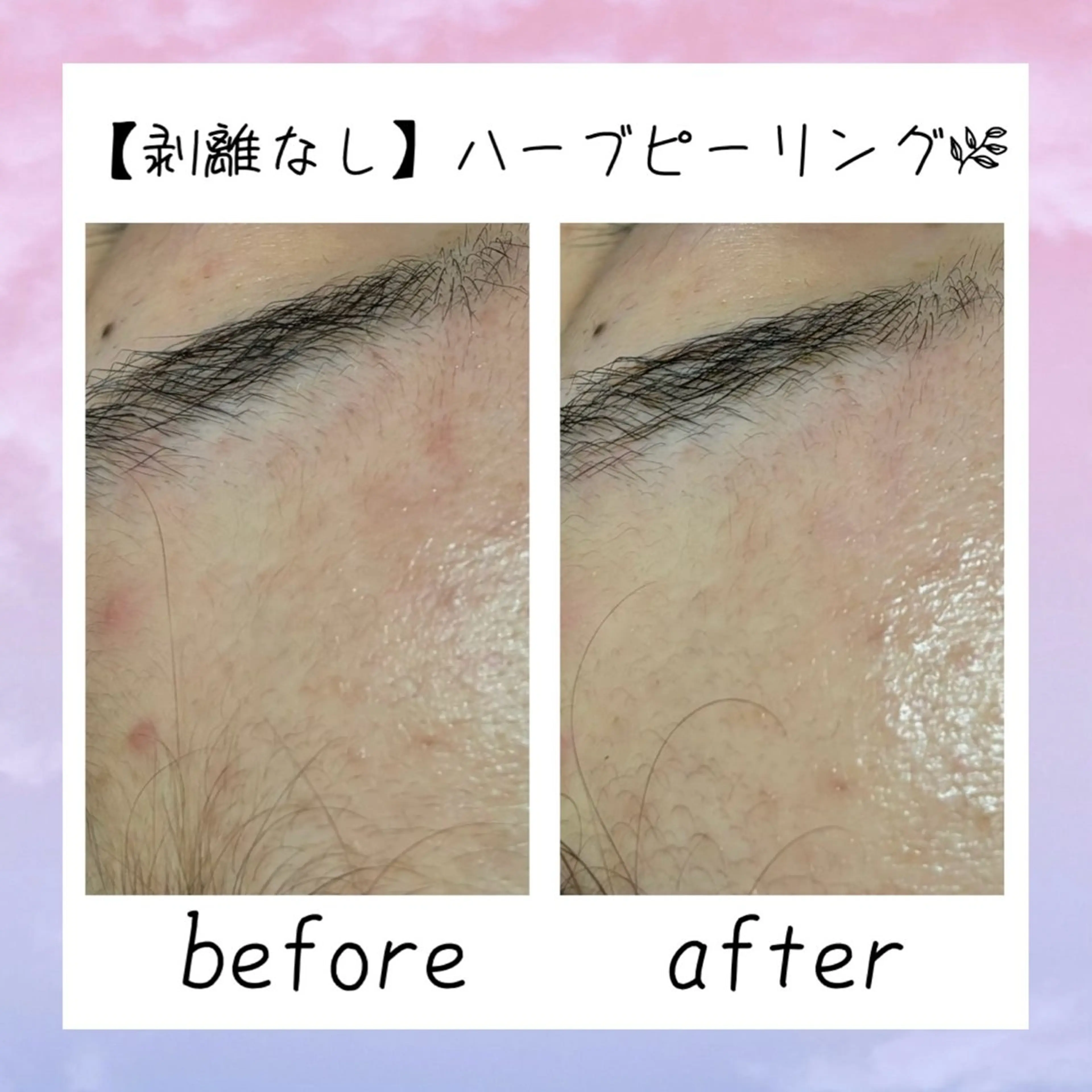 肌質改善Charme coco  増毛のエステ・リラクイメージ