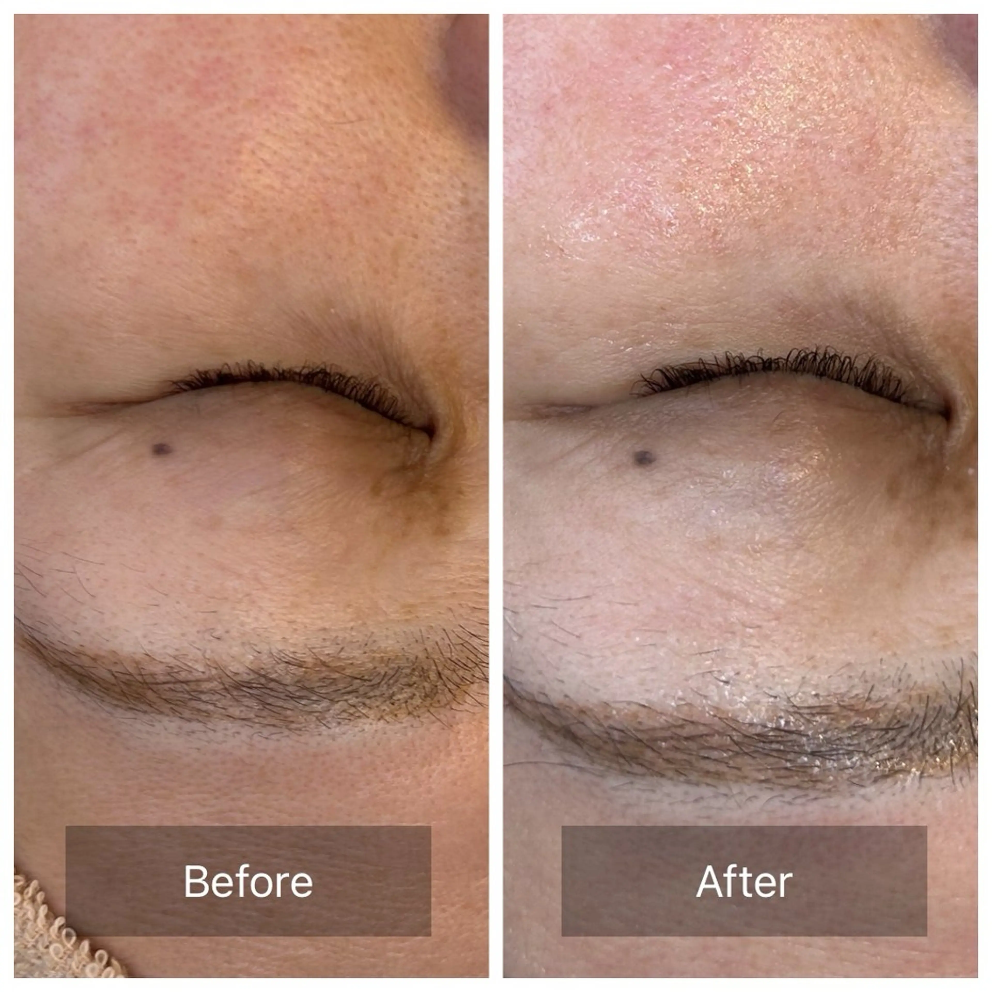 エステ リラク facial aesthetic salon SENTEUR所属・美肌改善/毛穴/シミ サントゥールのエステ・リラクイメージ