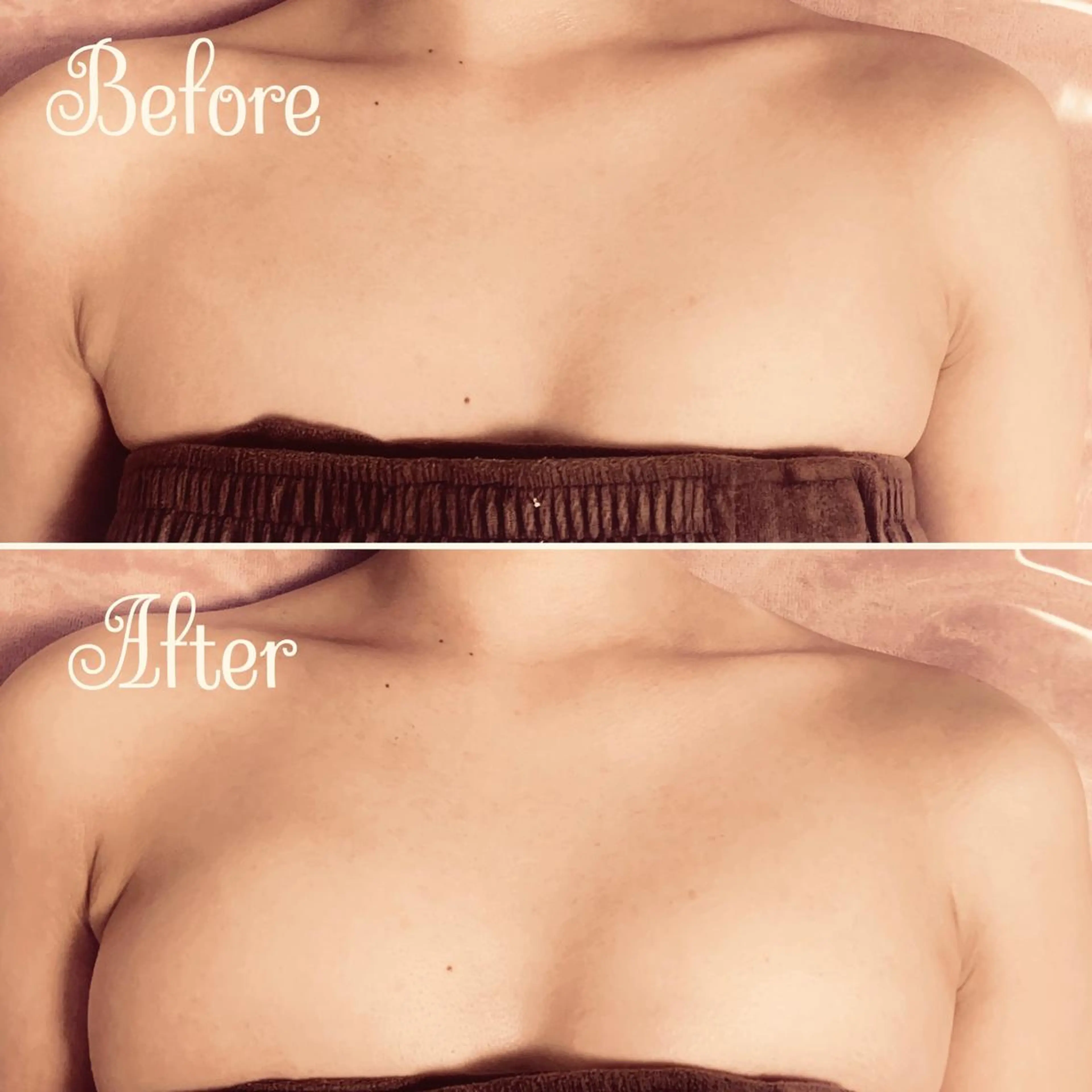 透明感の肌Lino malieのエステ・リラクイメージ