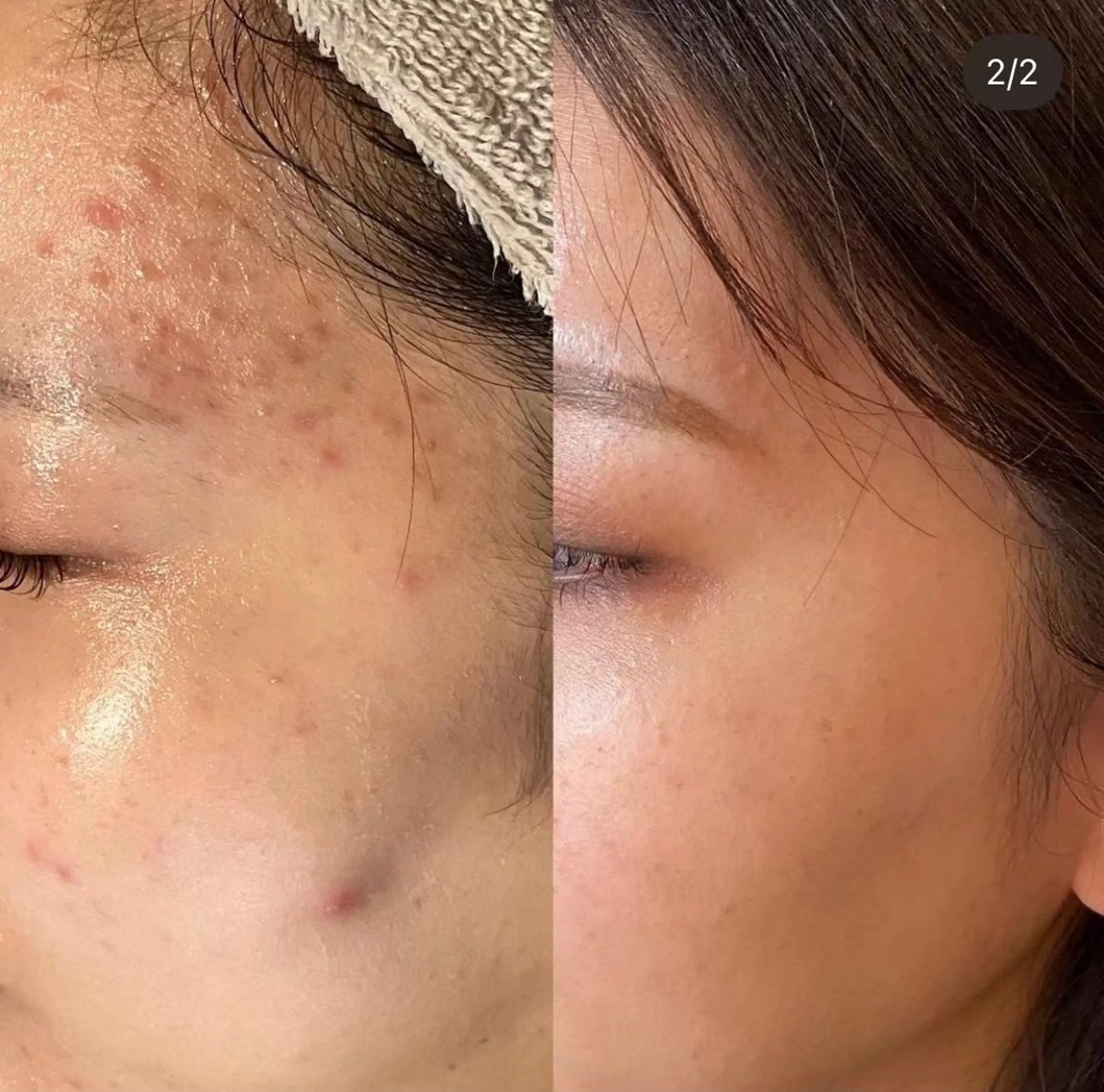 エステ 小顔×痩身専門サロンCLORE浦和店所属・石川 彩花のエステ・リラクイメージ