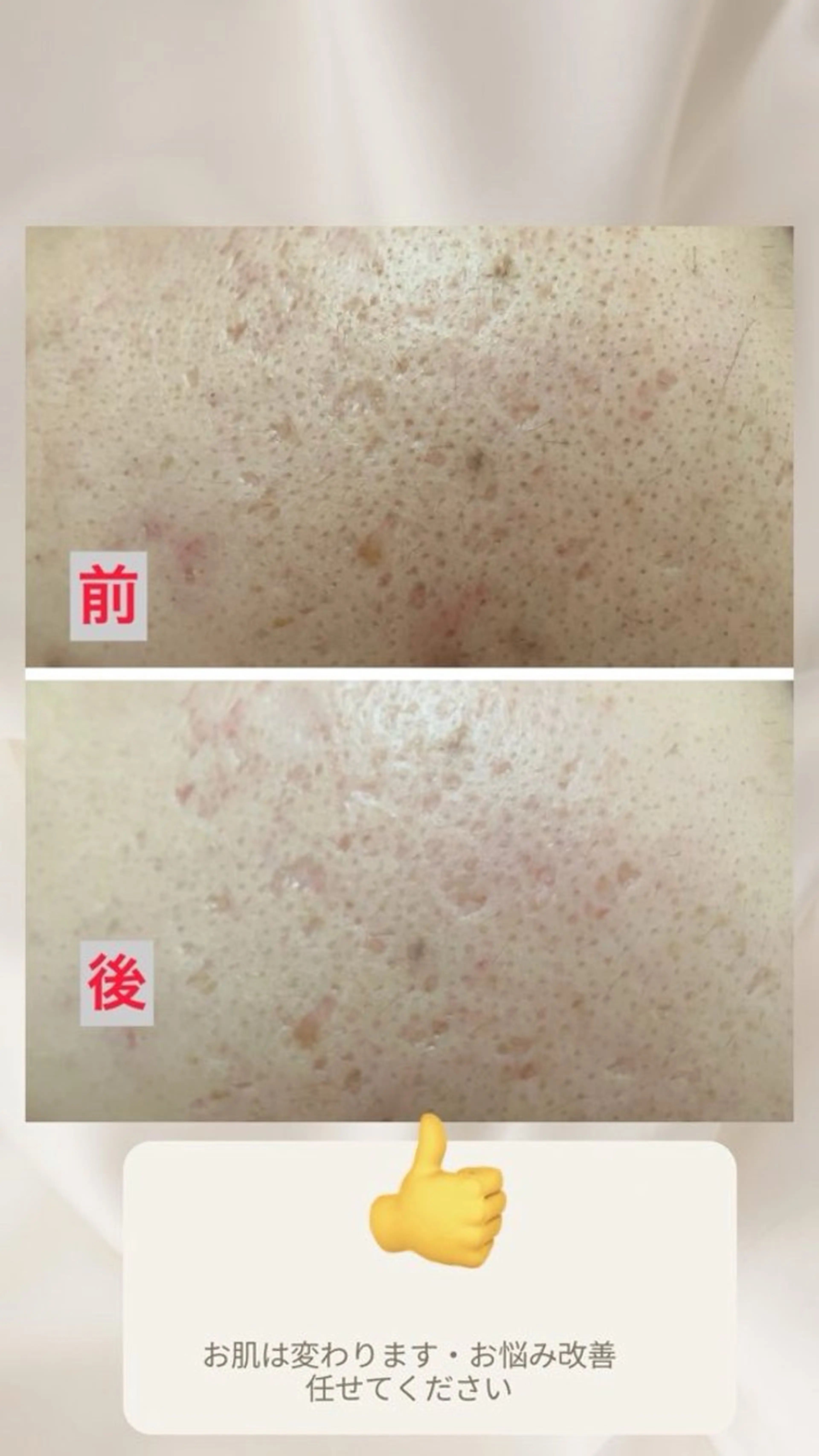 その他 たるみ改善小顔エステ 堀葉月のその他イメージ