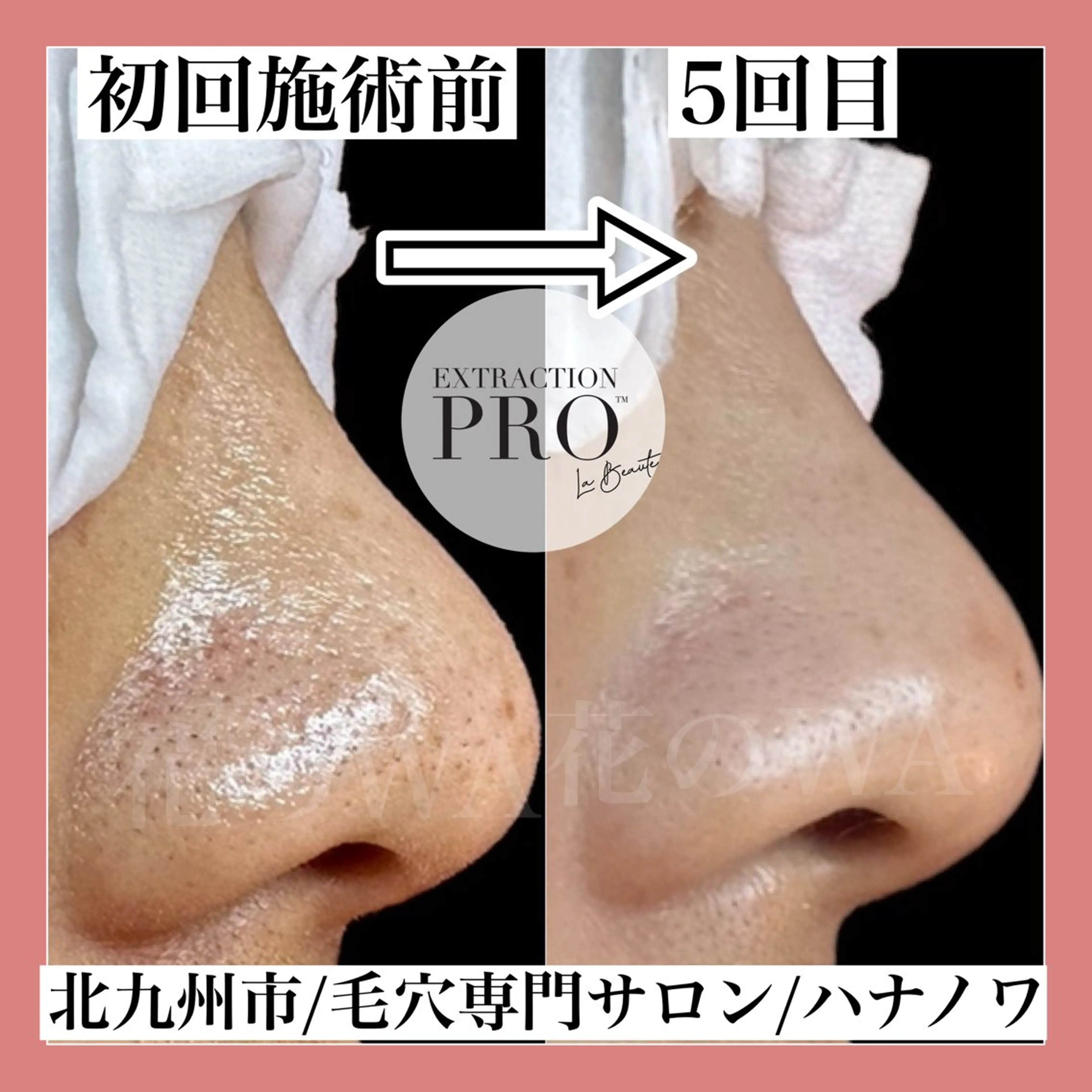 エステ リラク 毛穴&リンパマッサージ専門サロン　花のWA所属・毛穴&リンパマッサー ジ専門サロン花のWAのエステ・リラクイメージ