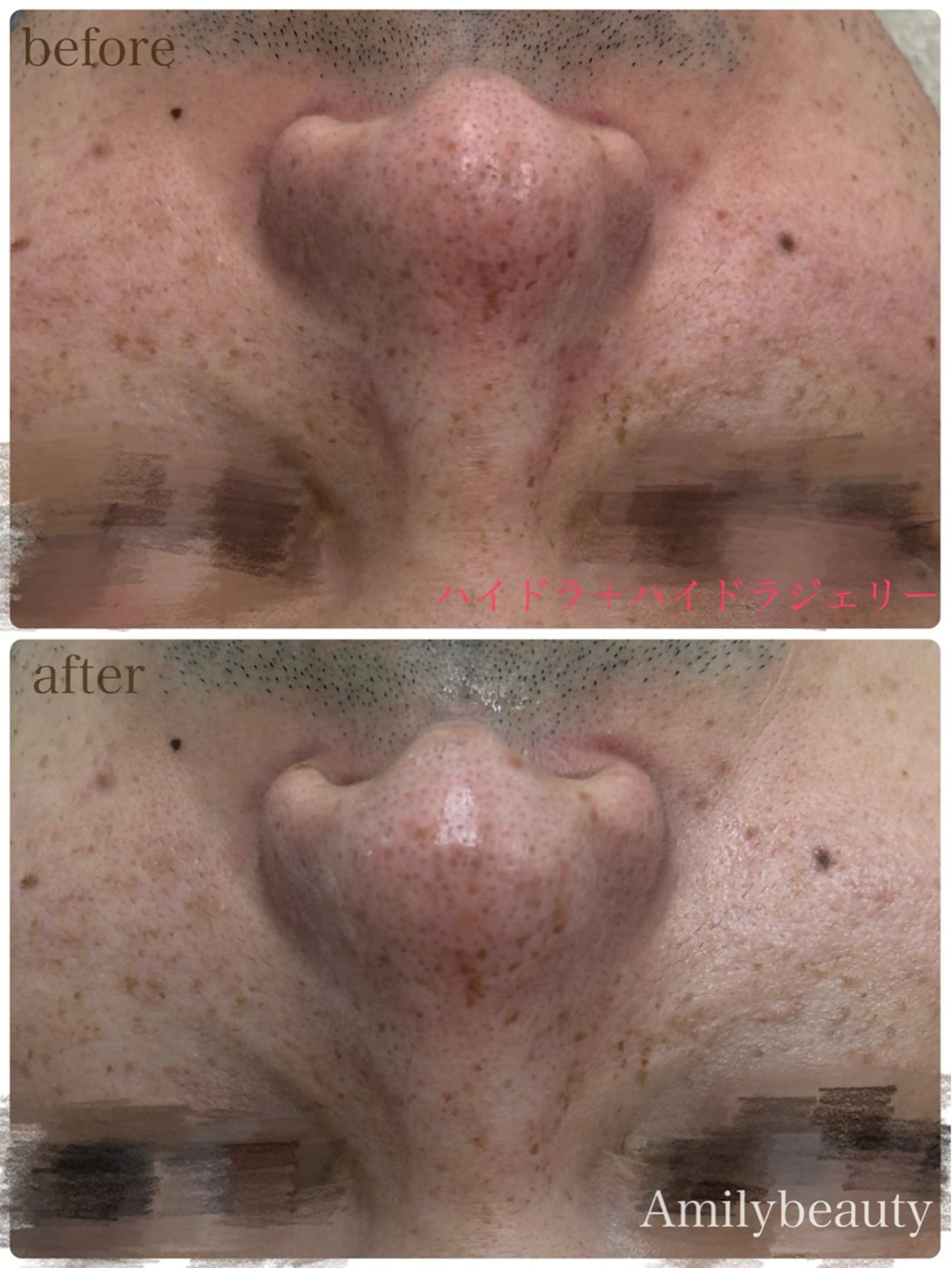 Amilybeauty所属・Amily beauty 毛利のその他イメージ