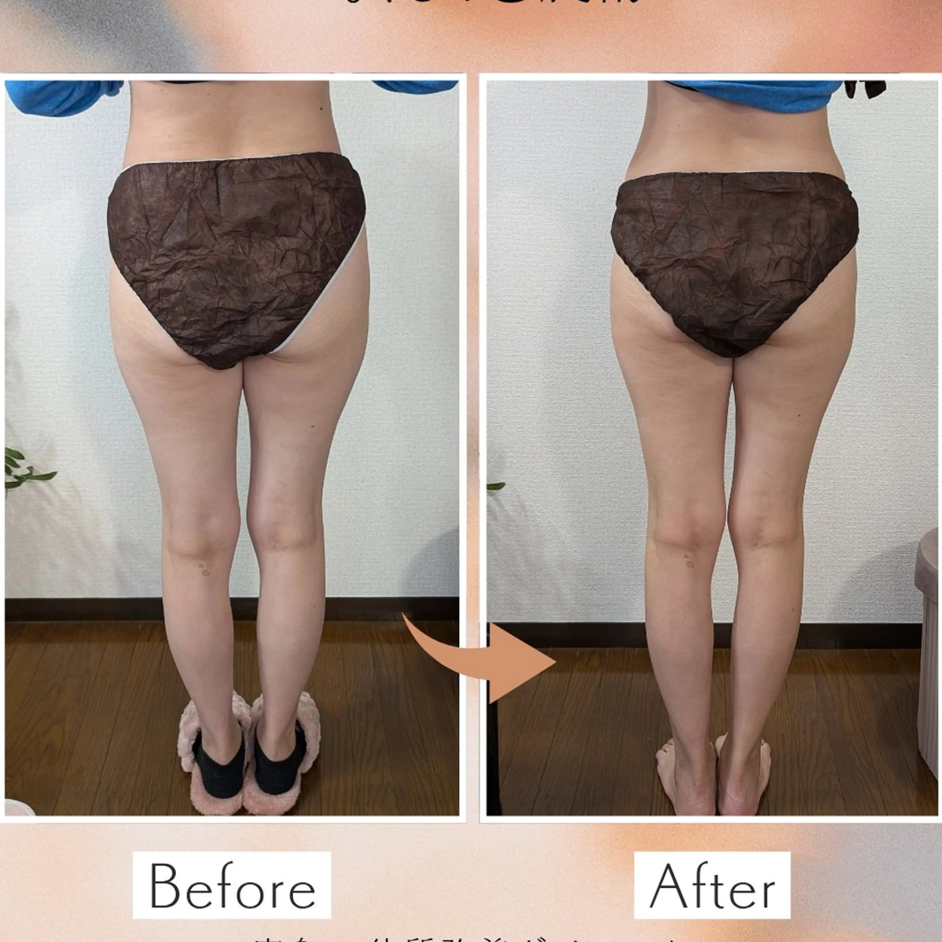 【痩身▪️体質改善ダイエット】美養サロンEnbi~縁美~所属・美養サロンEnbi ~縁美~のエステ・リラクイメージ