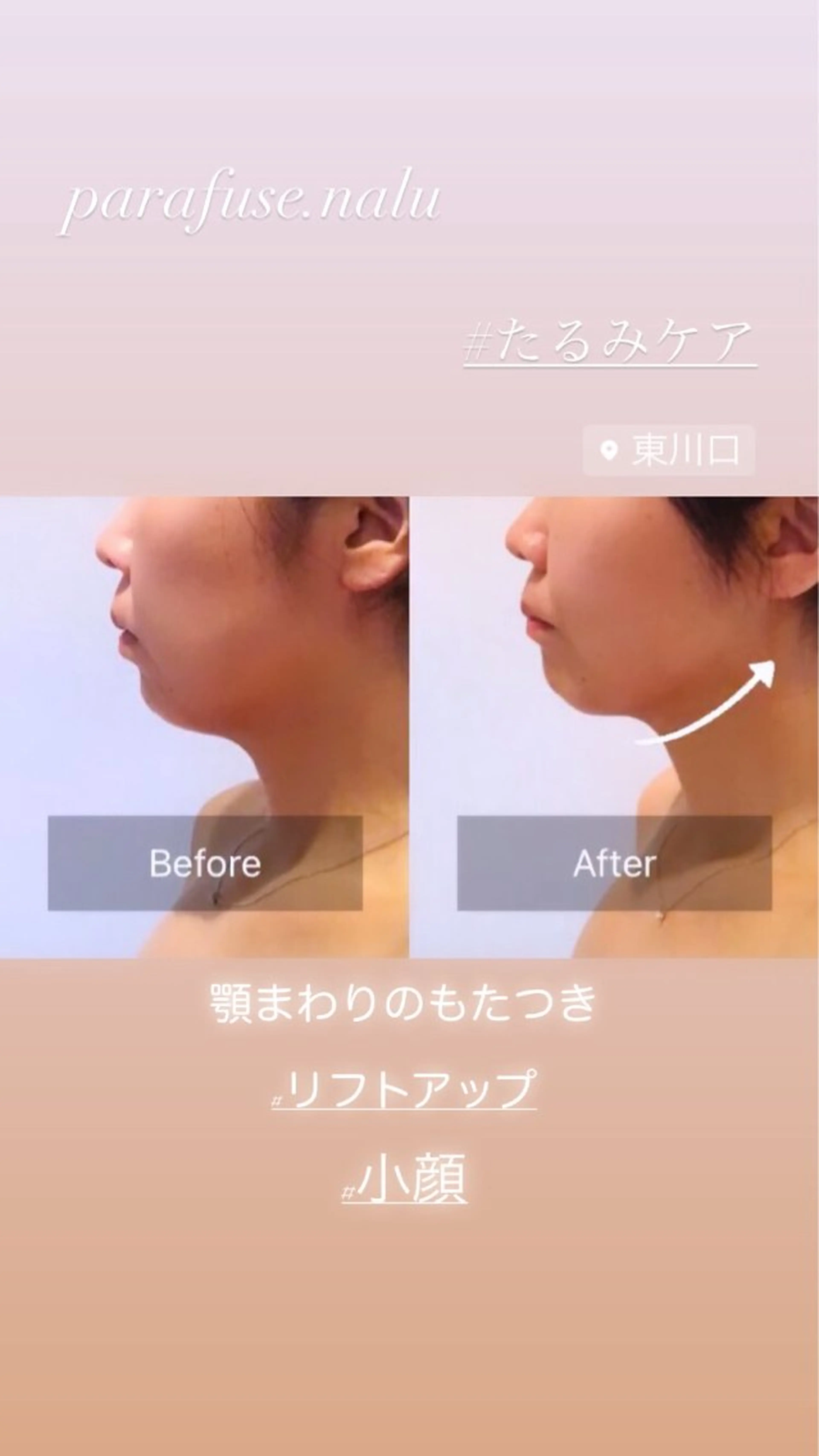 たるみケアフェイシャル&ヘッドを体験していただきお写真撮影にご協力いただける方‼︎特別価格でのご案内となります✨の写真