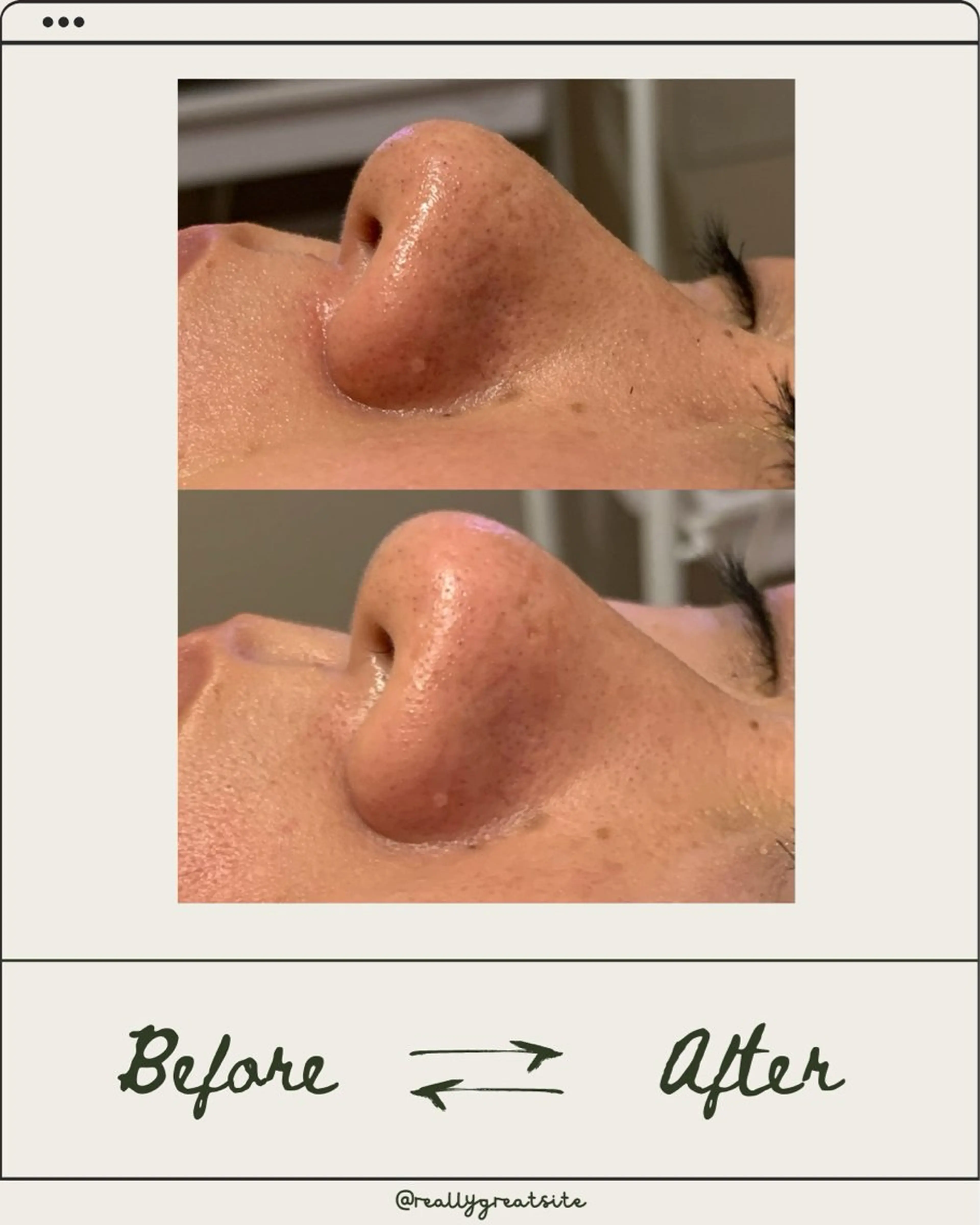 Linné  Yomogi Spa所属・Linné Amiのエステ・リラクイメージ