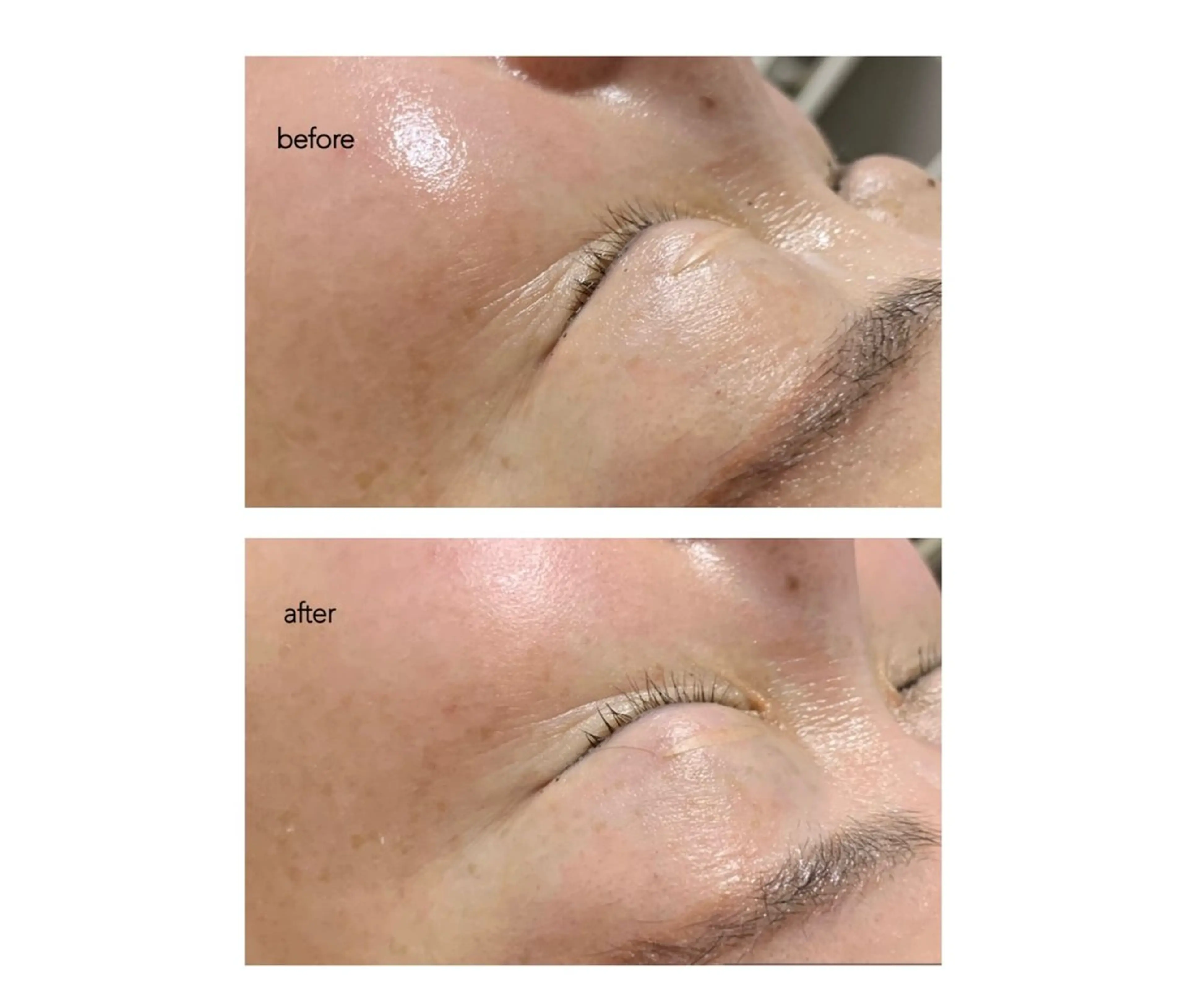 エステ miyasaka erikoのネイルデザイン