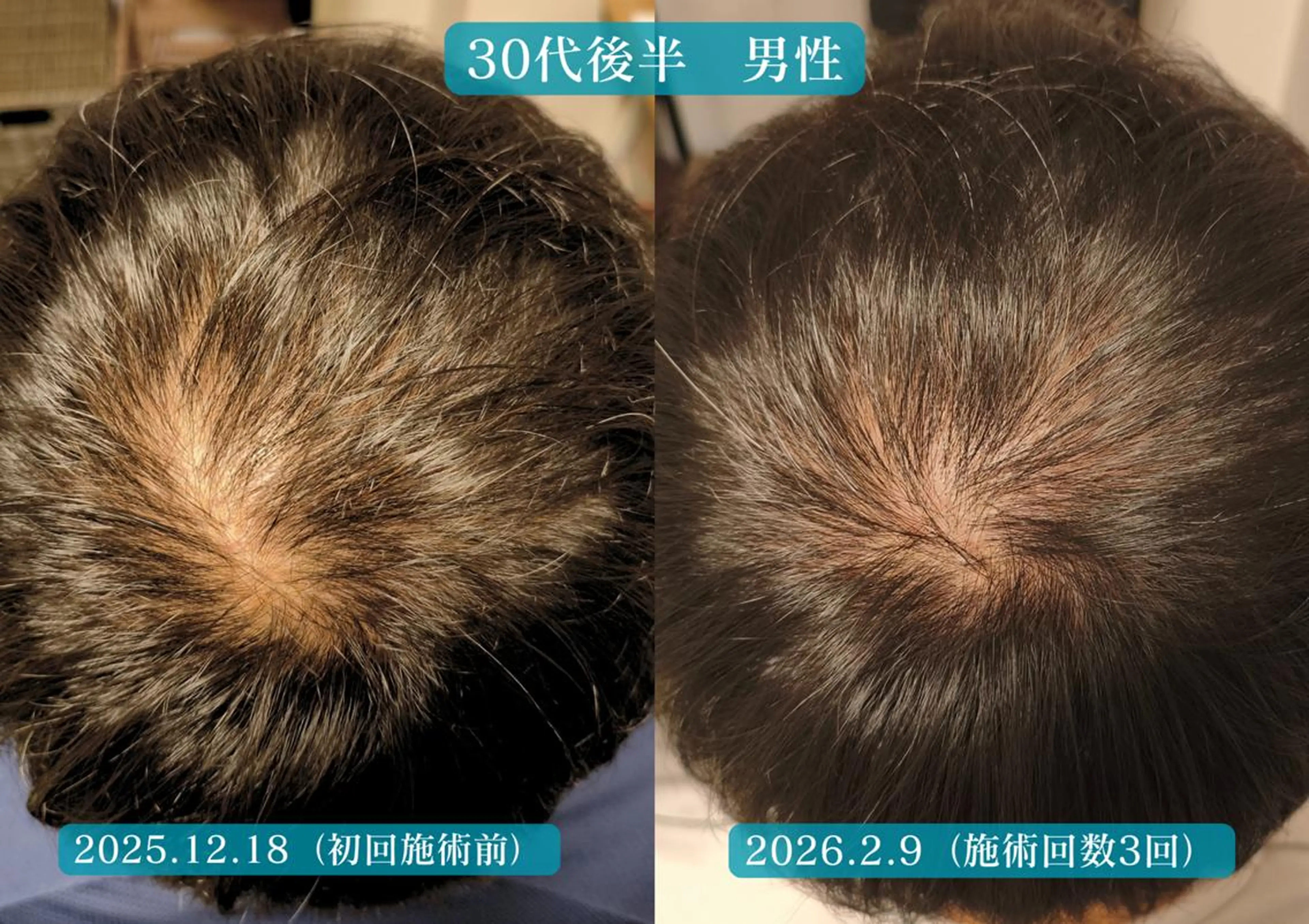 エステ リラク 美容とカラダの鍼灸 サロン やなけんのエステ・リラクイメージ