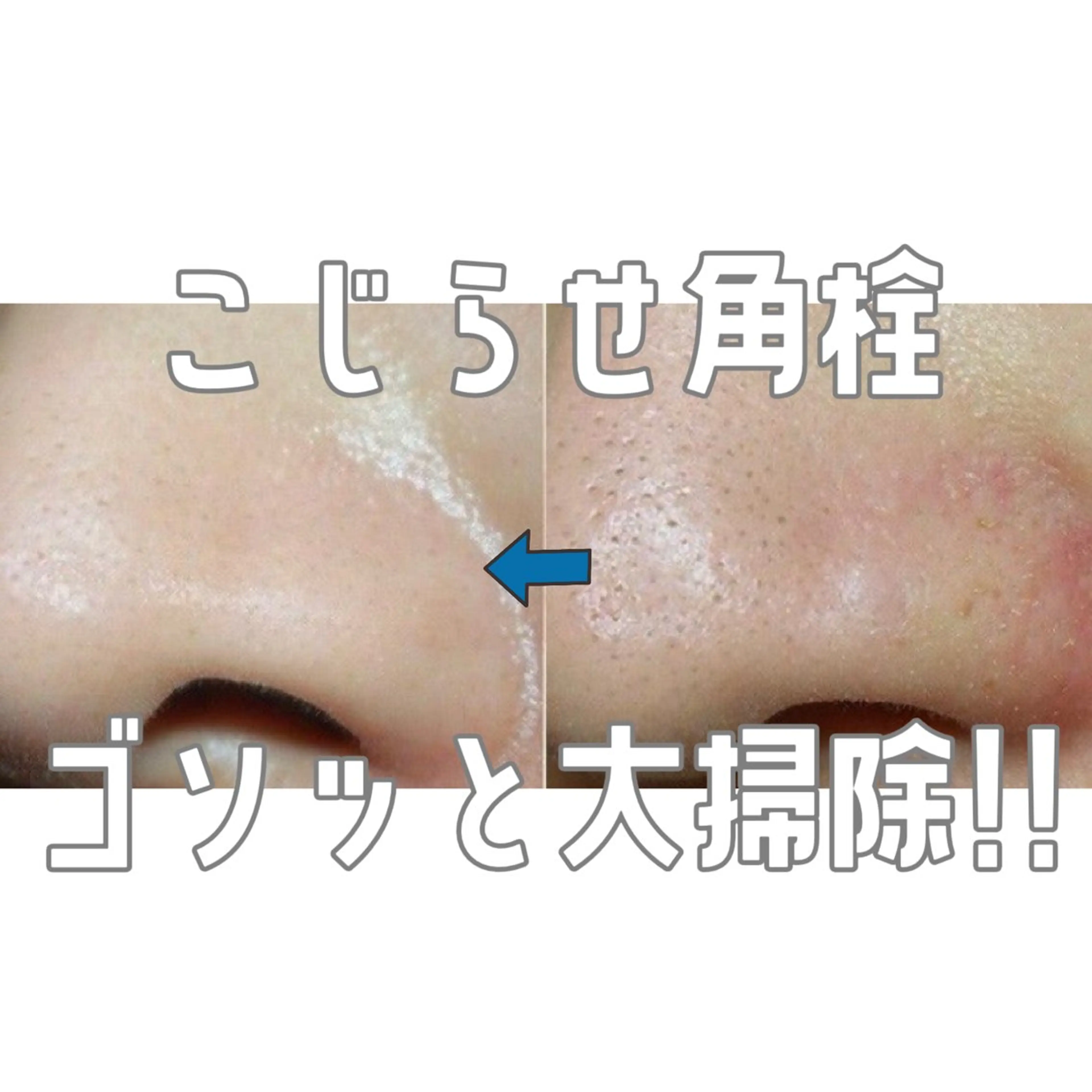 Sugaring / HILOT TAOのエステ・リラクイメージ