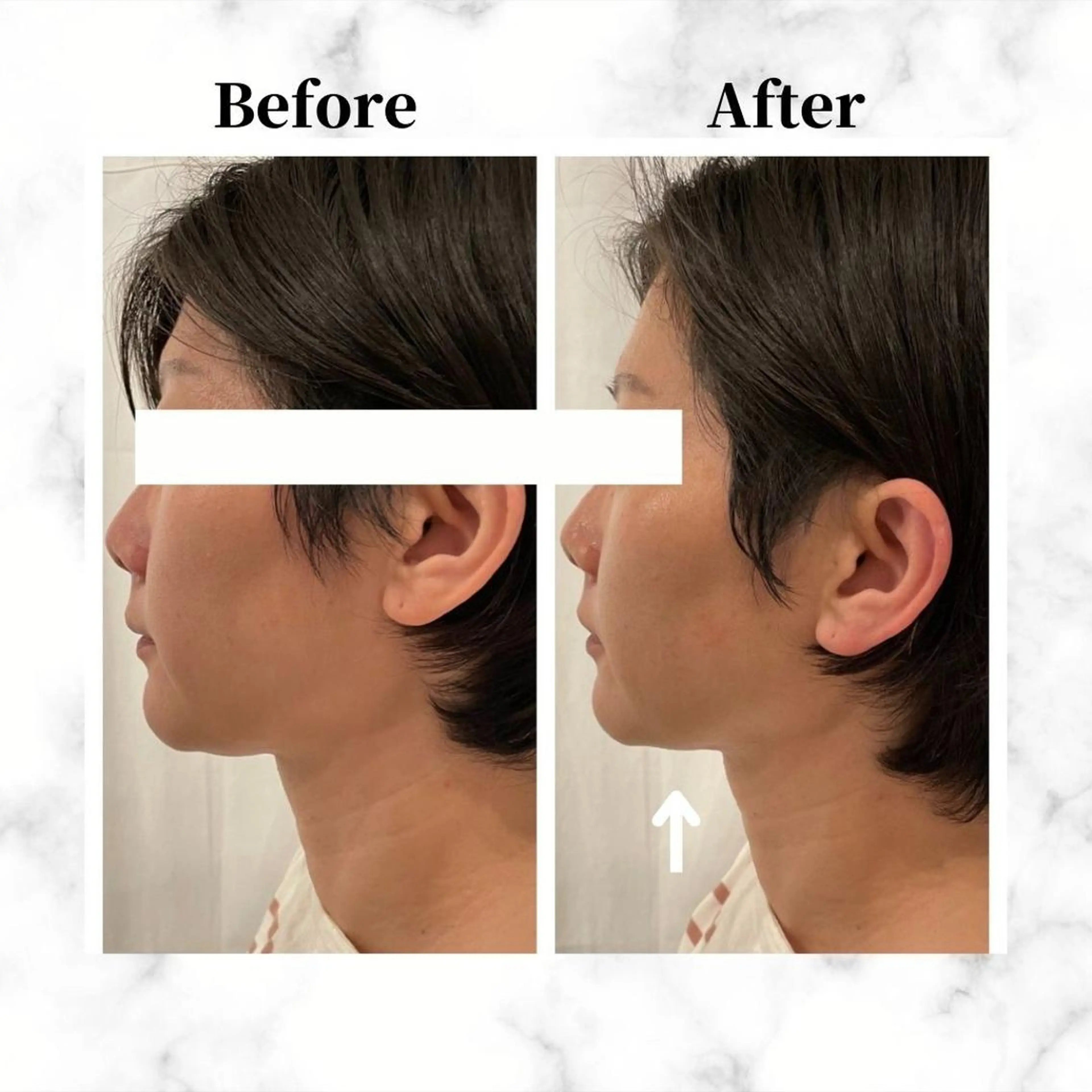 エステ リラク 12Dハイフ💗 最強小顔のエステ・リラクイメージ